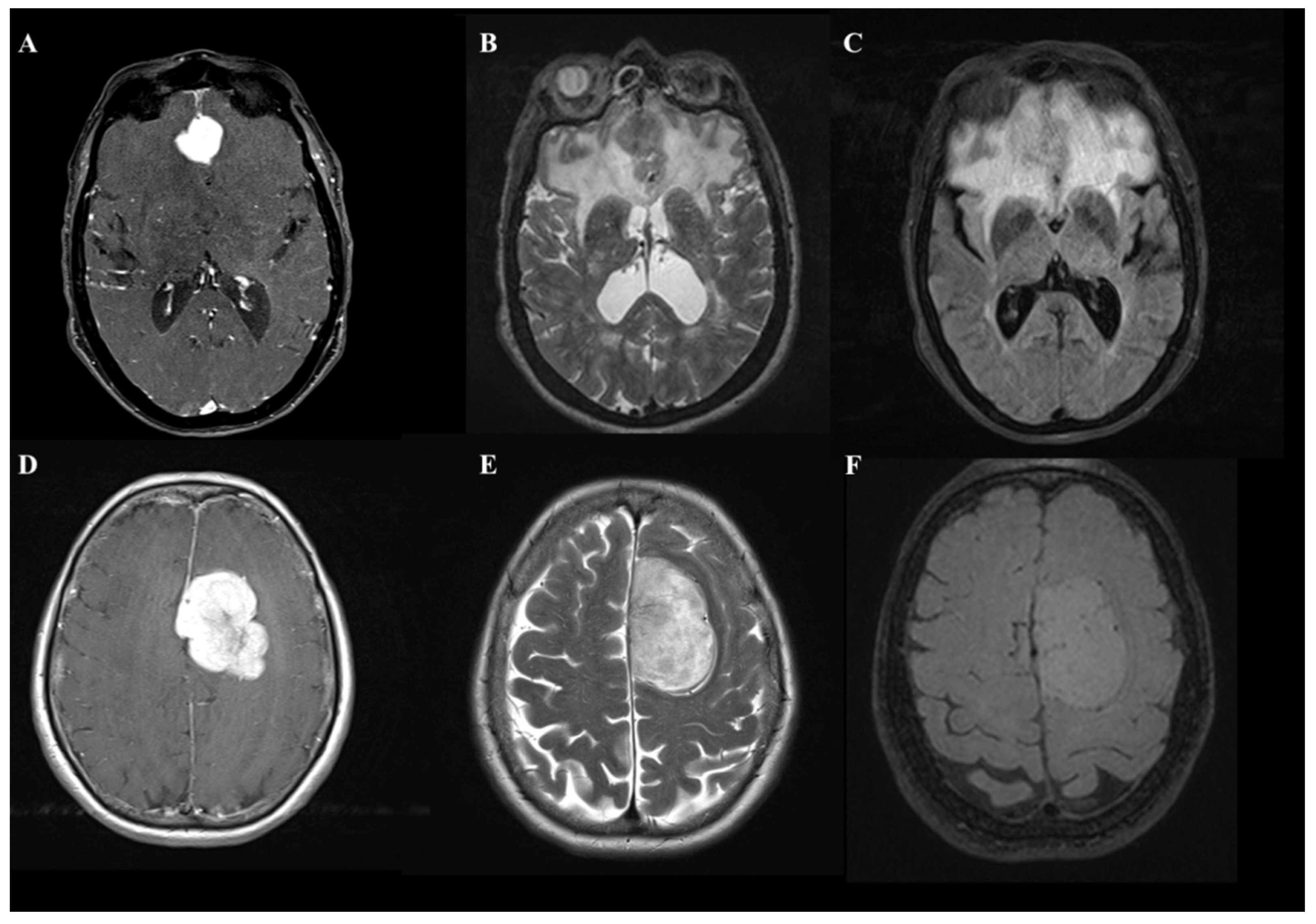 Tomography 08 00166 g001 550