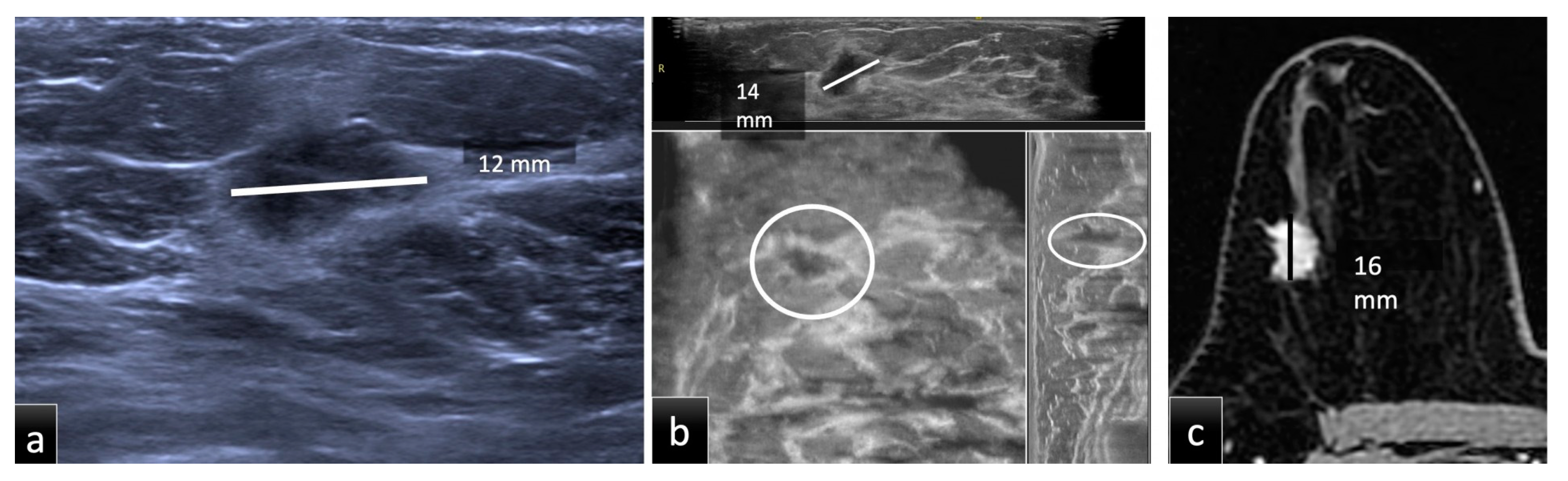 Tomography 08 00167 g001 550