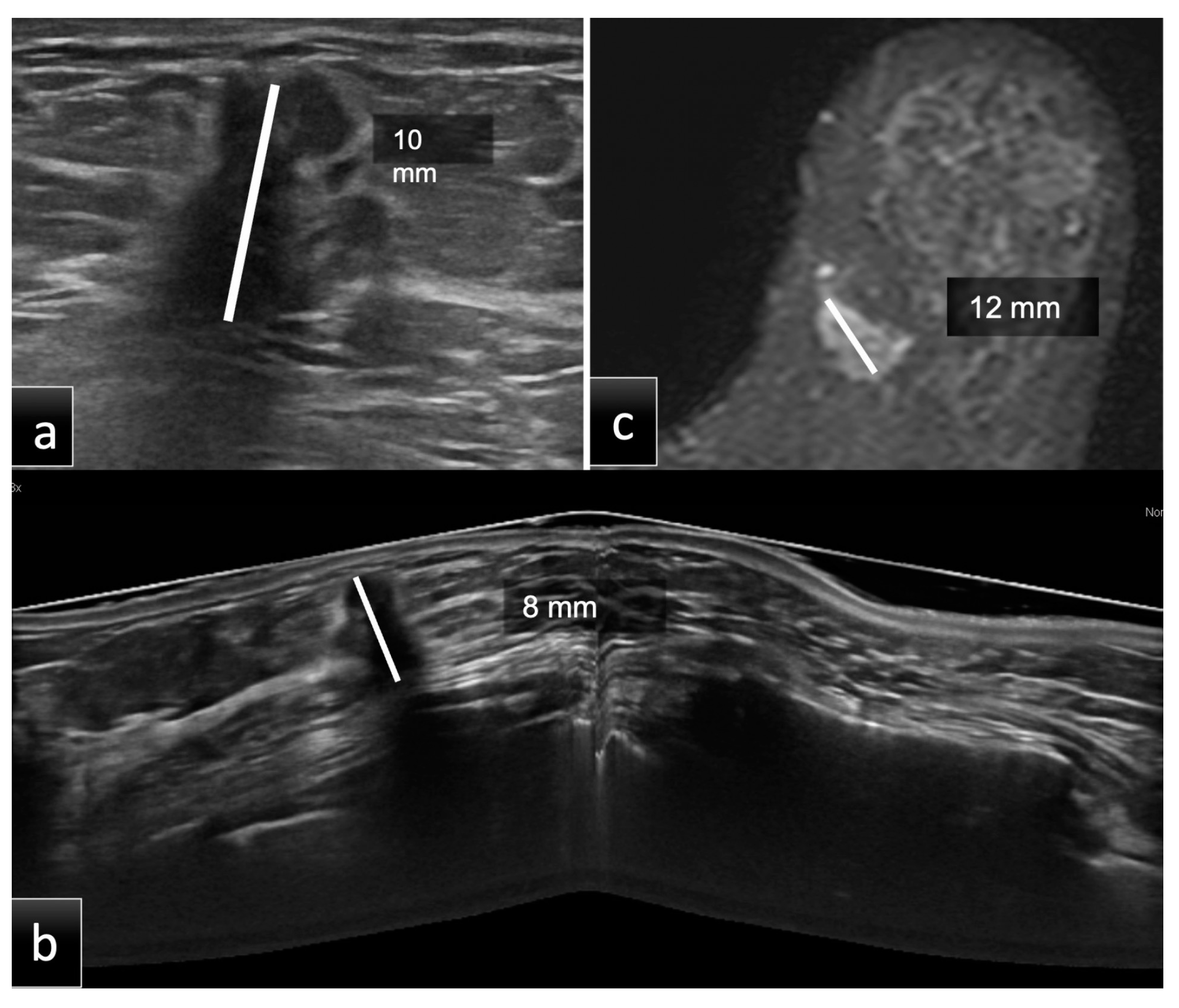 Tomography 08 00167 g002 550