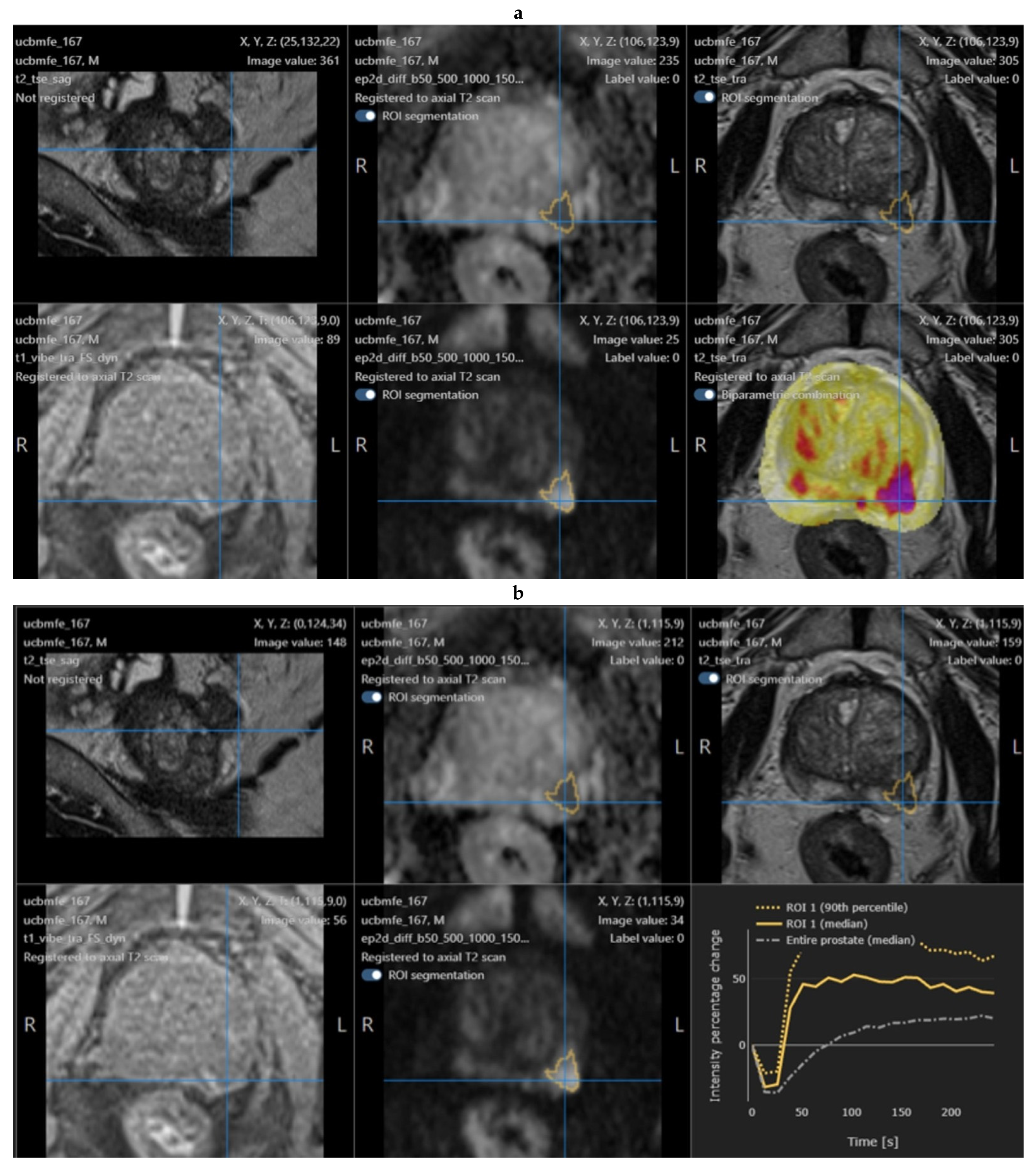 Tomography 08 00168 g001