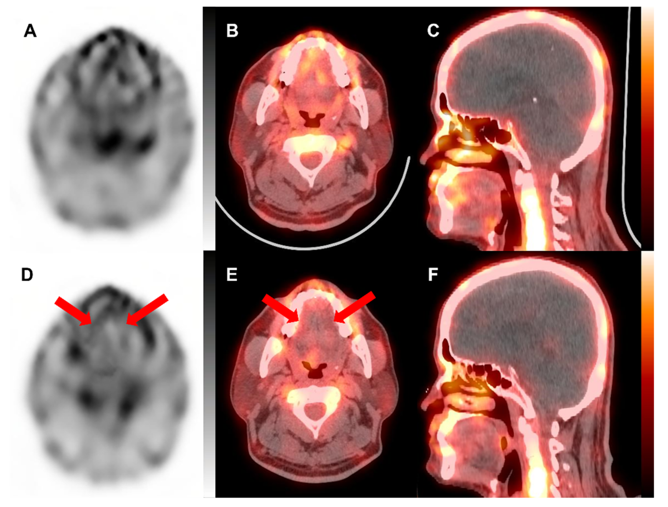 Tomography 08 00171 g002