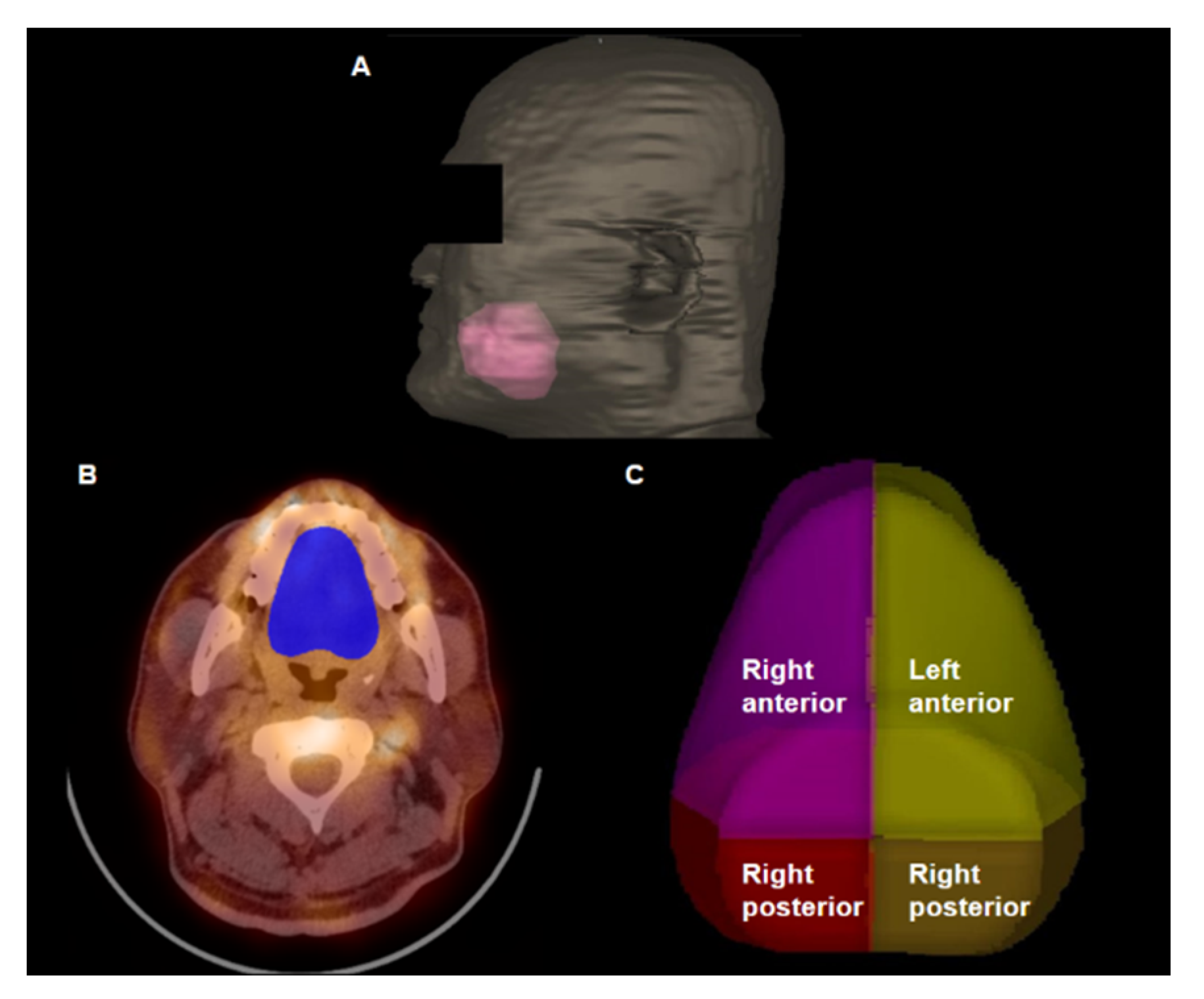Tomography 08 00171 g003