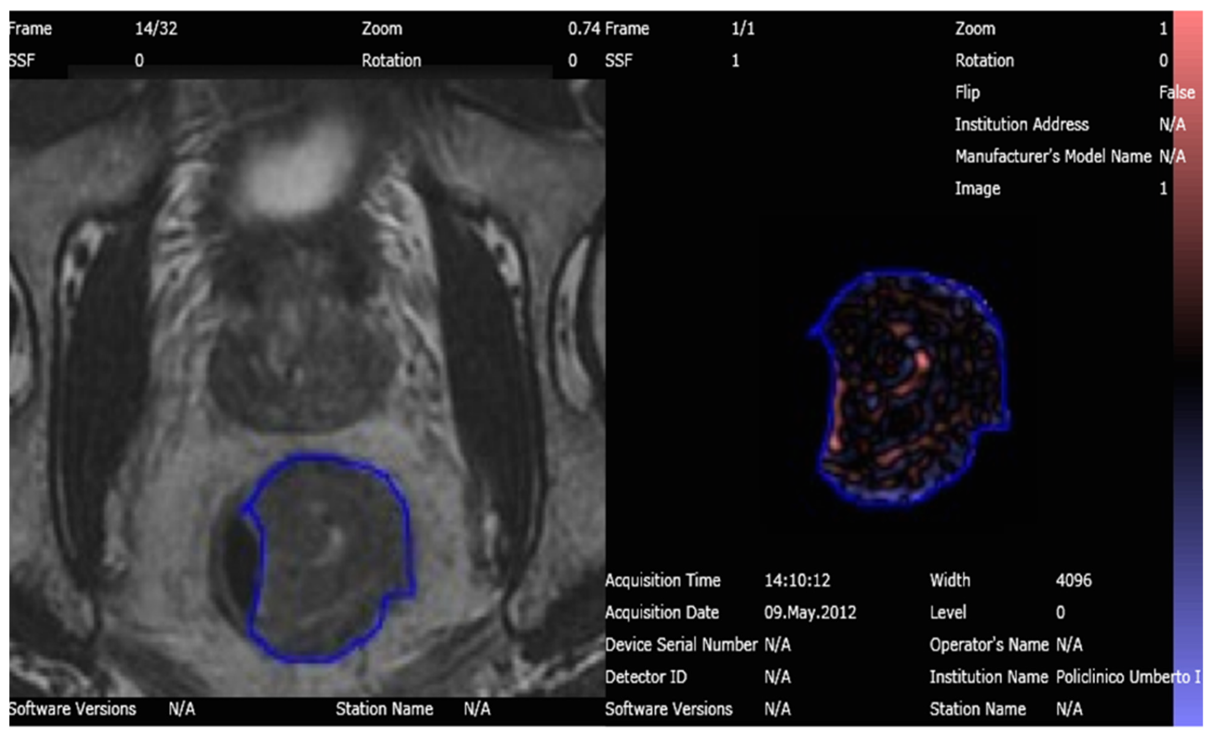 Tomography 08 00173 g002