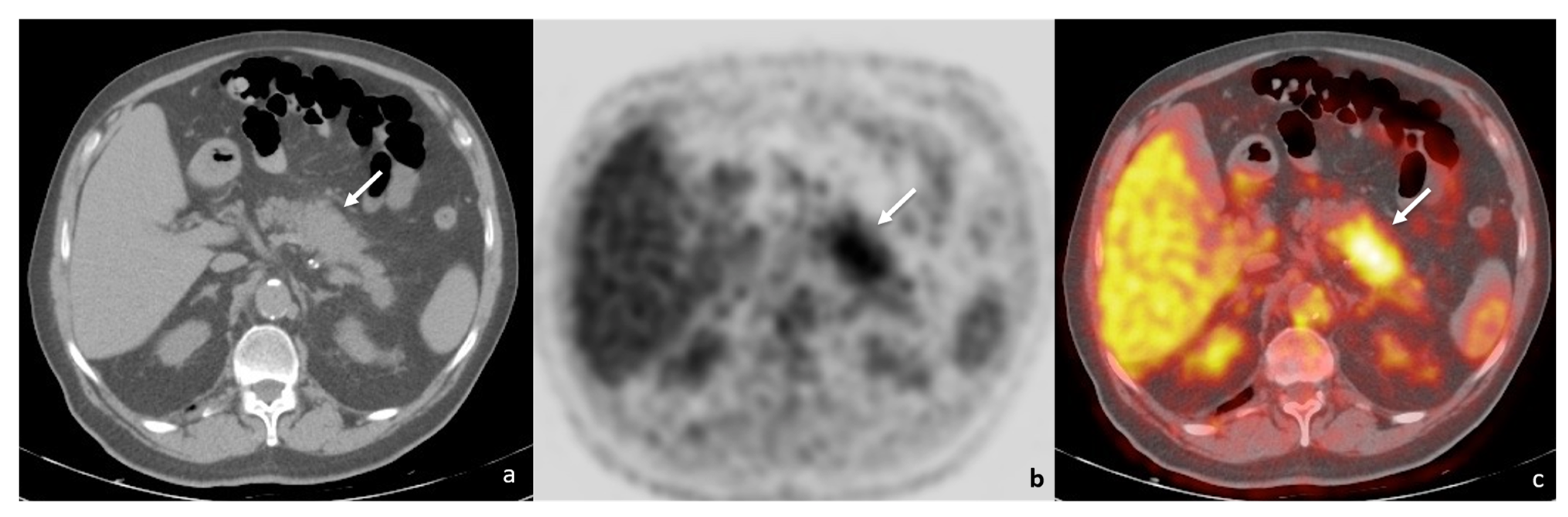 Tomography 08 00174 g001 550