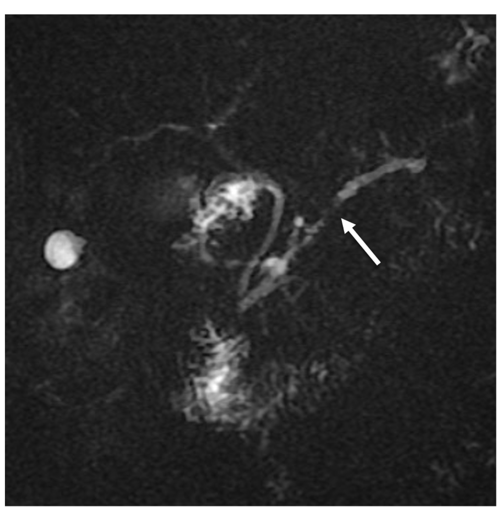 Tomography 08 00174 g003 550
