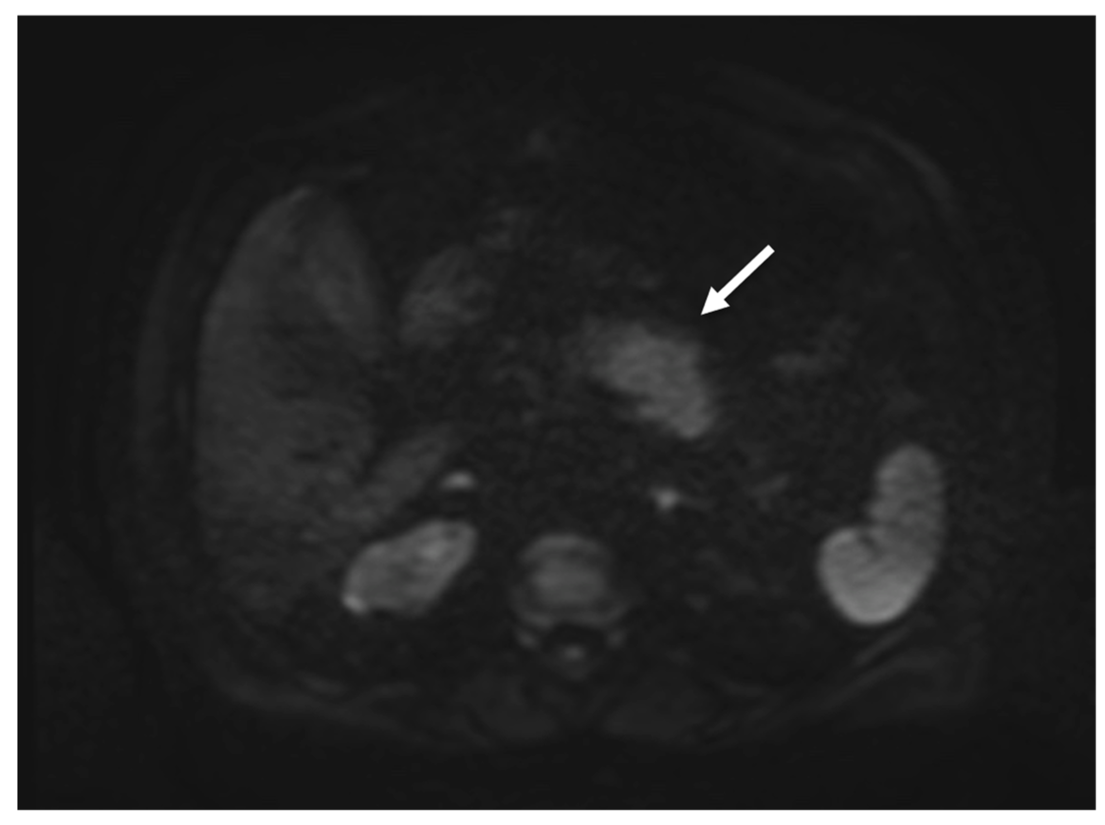 Tomography 08 00174 g004 550