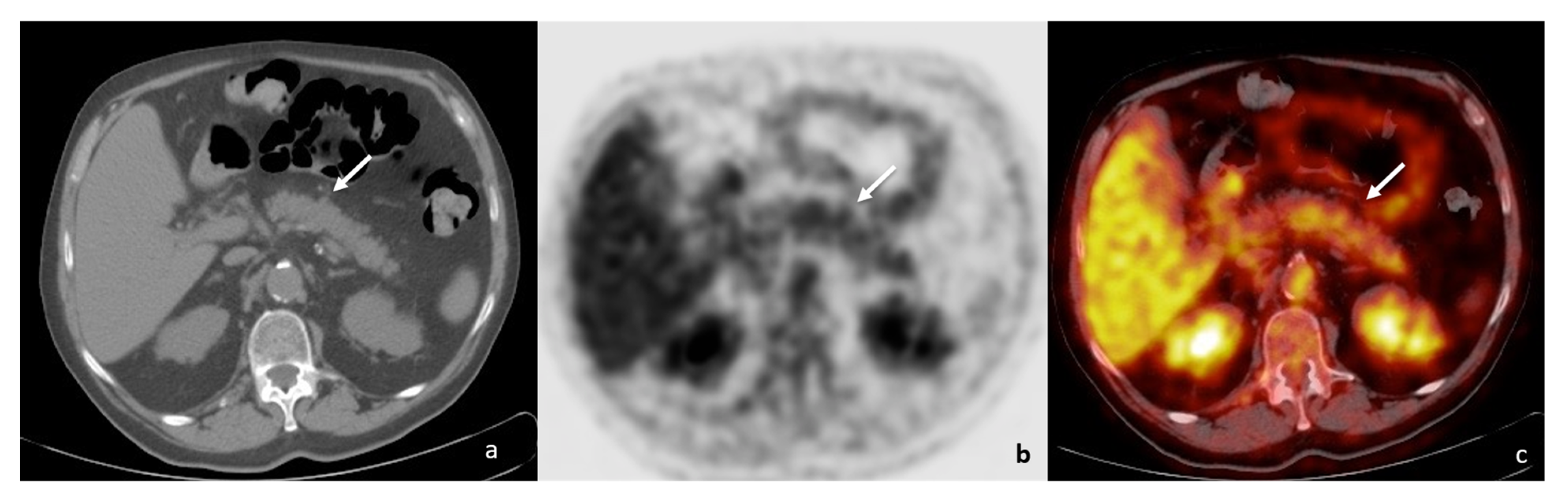 Tomography 08 00174 g008 550