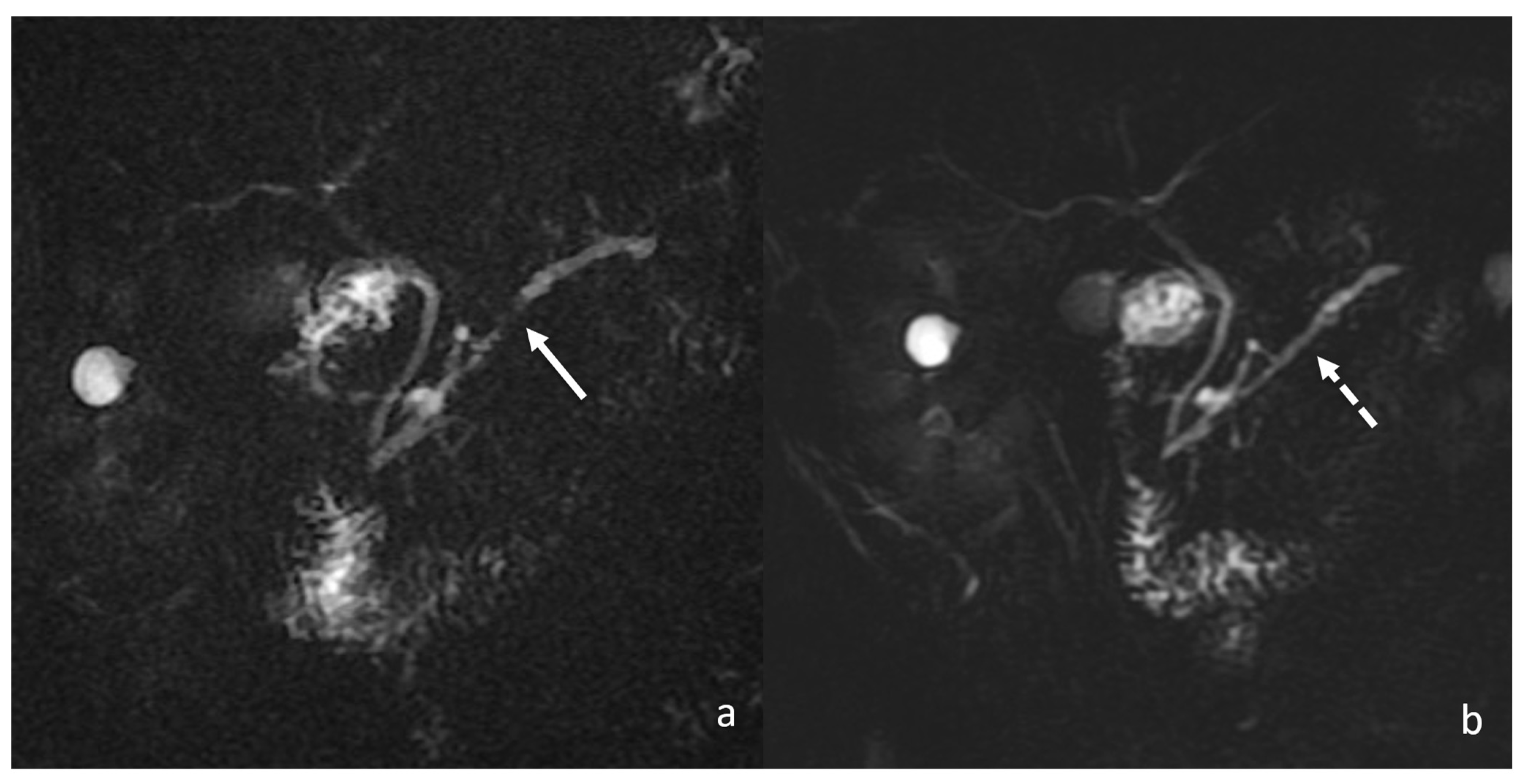 Tomography 08 00174 g009 550