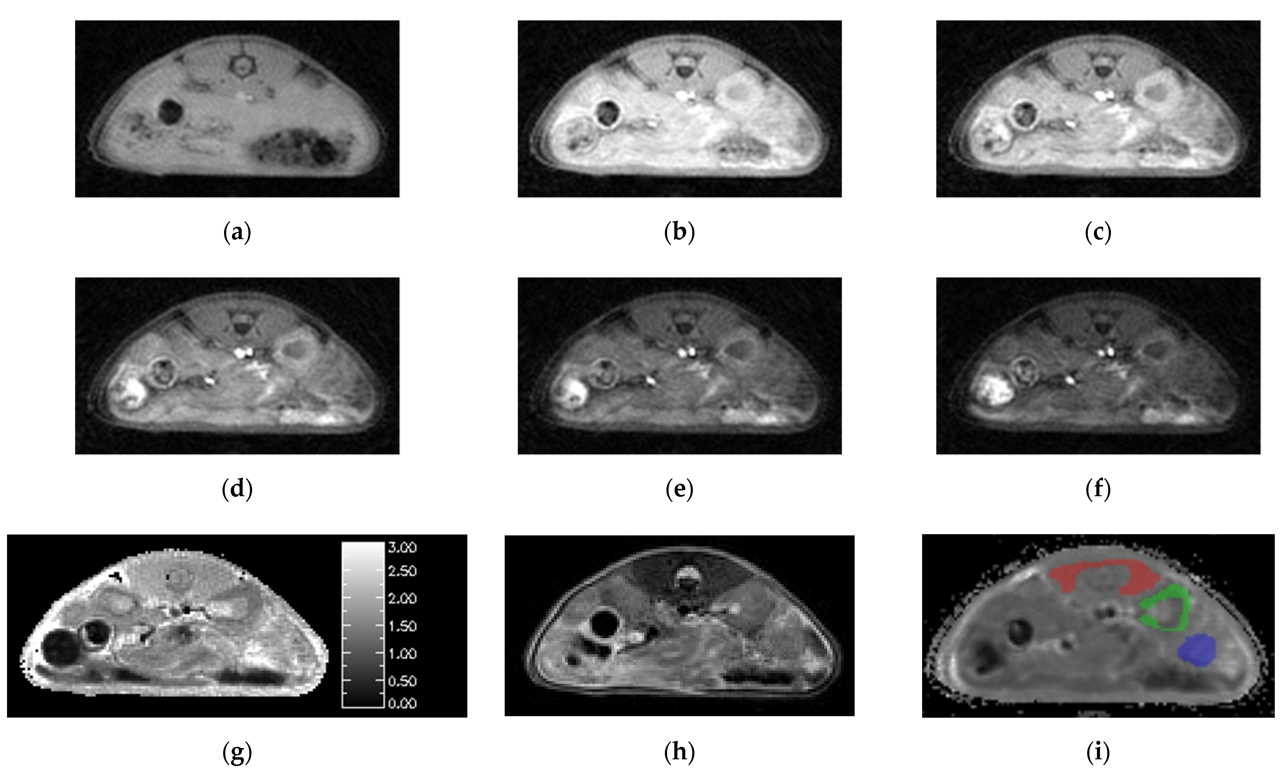 Tomography 08 00178 g003
