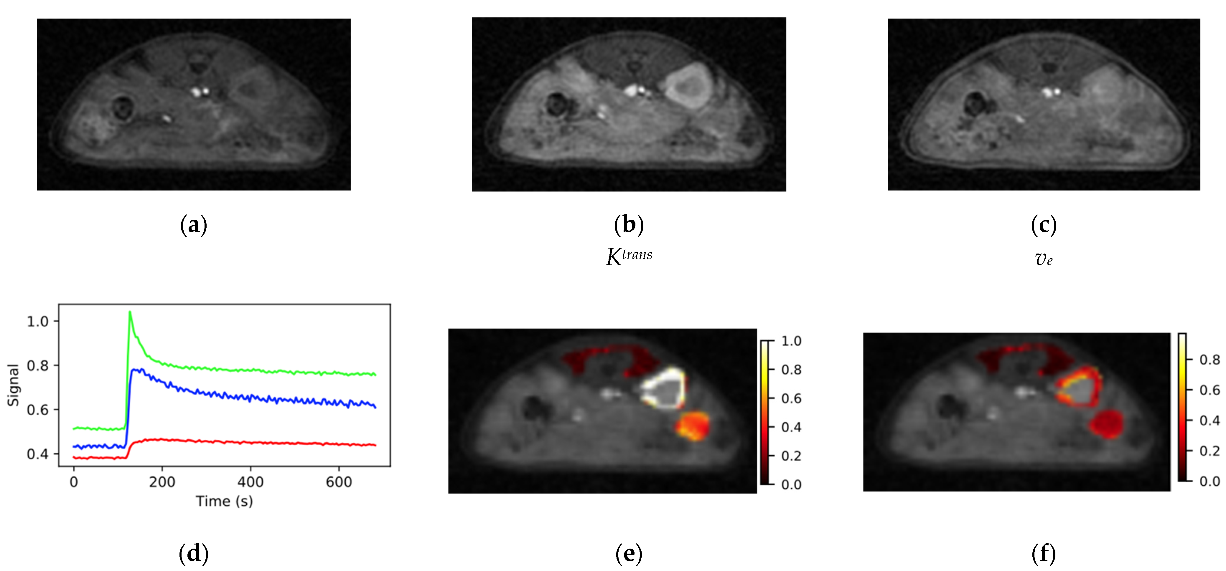 Tomography 08 00178 g005