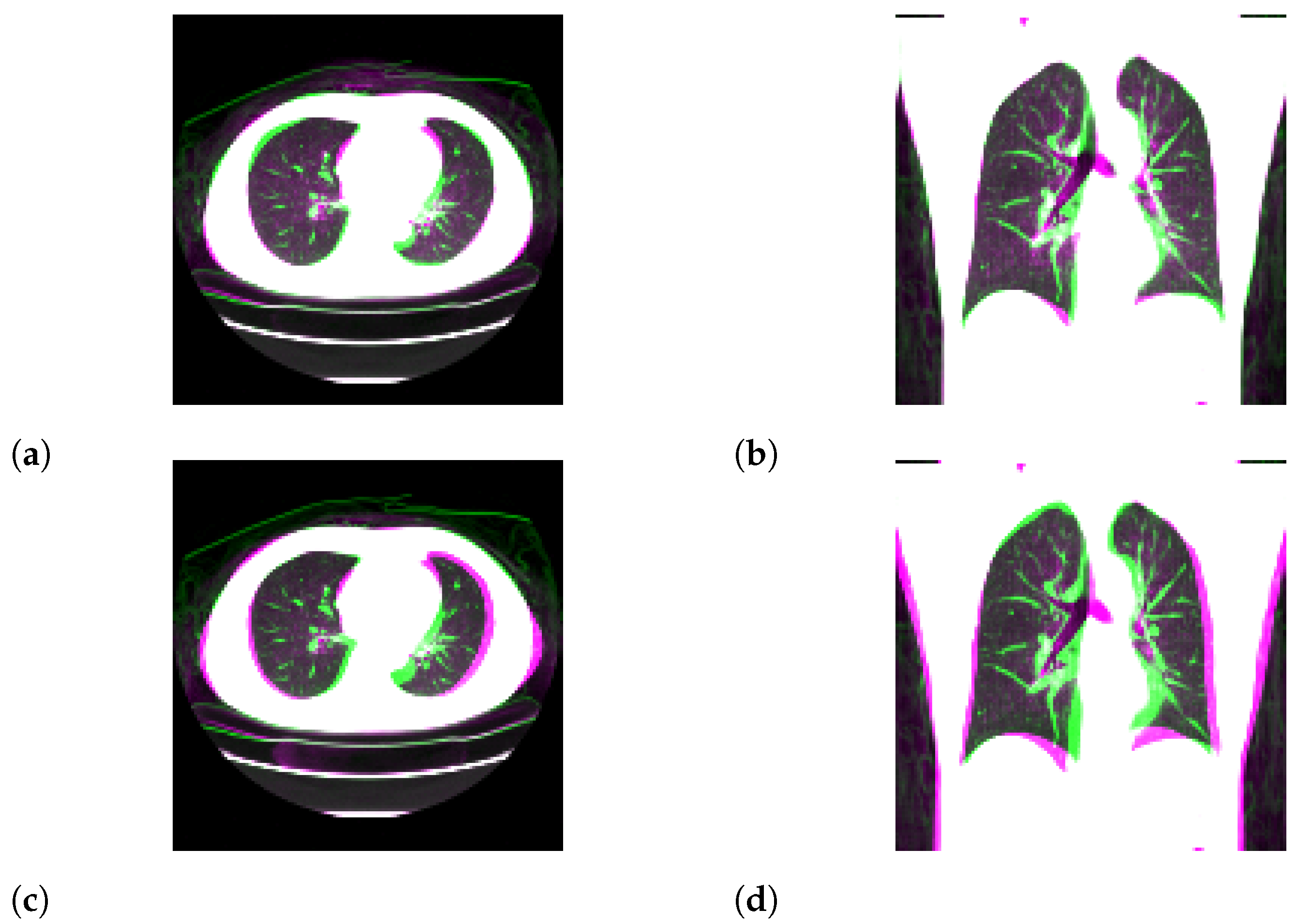 Tomography 08 00179 g006 550