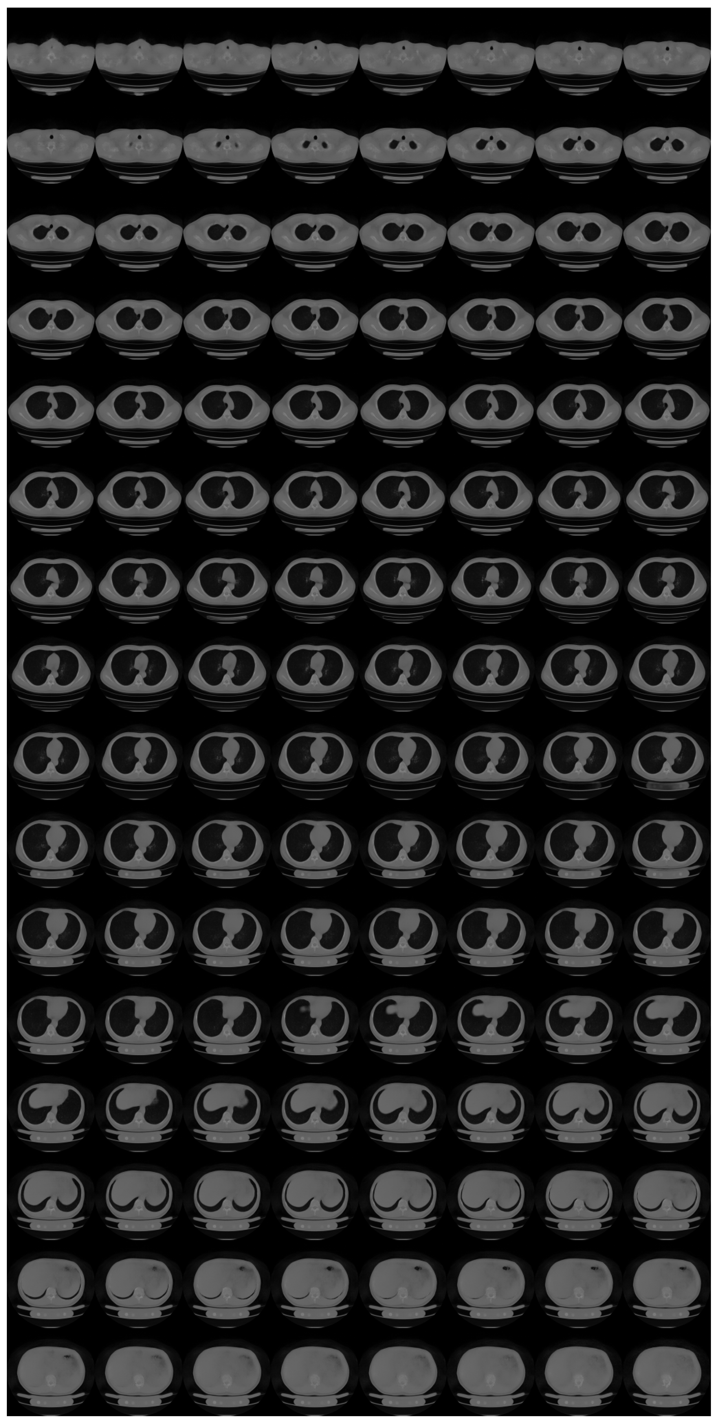 Tomography 08 00179 g0a4