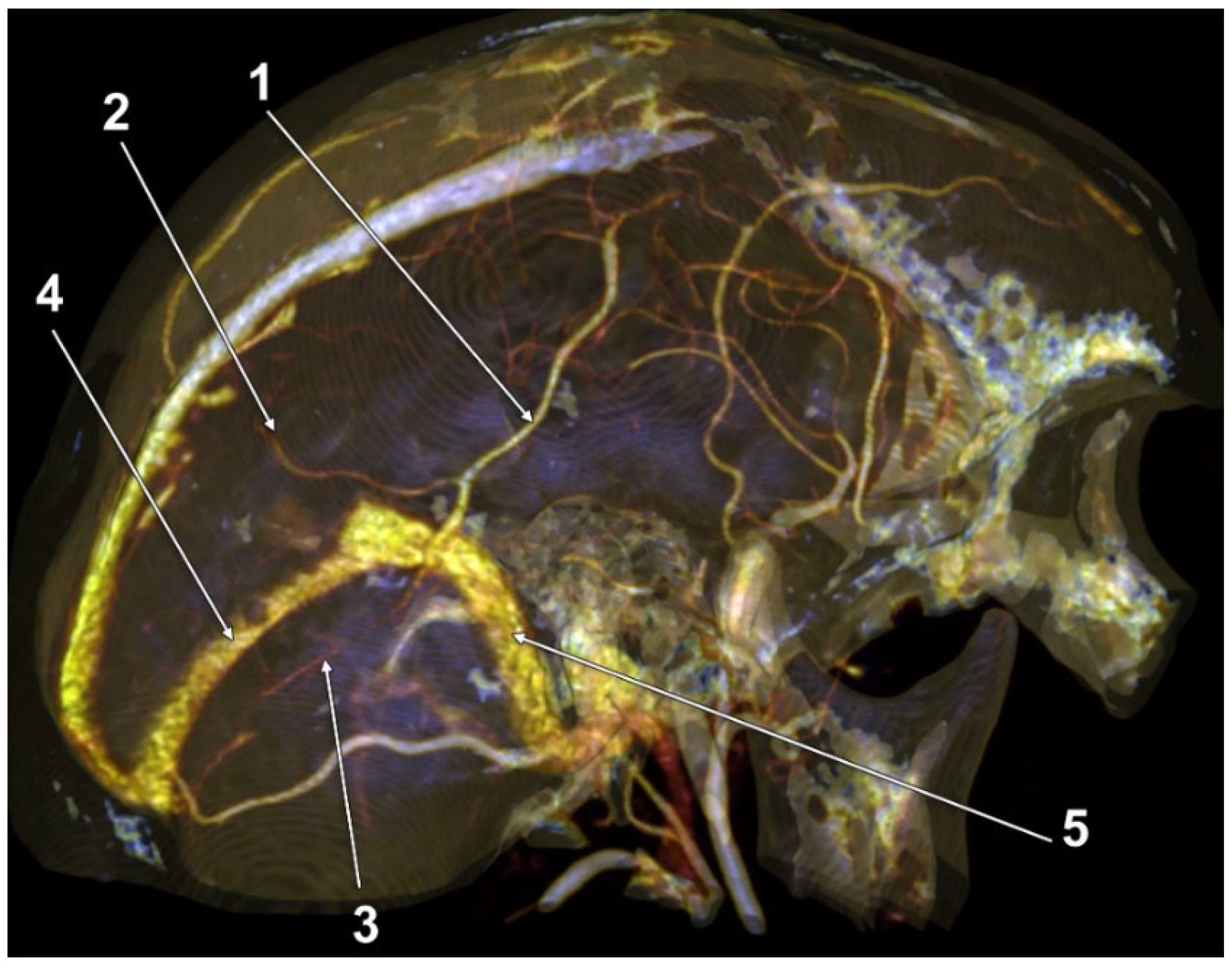 Tomography 08 00183 g002 550