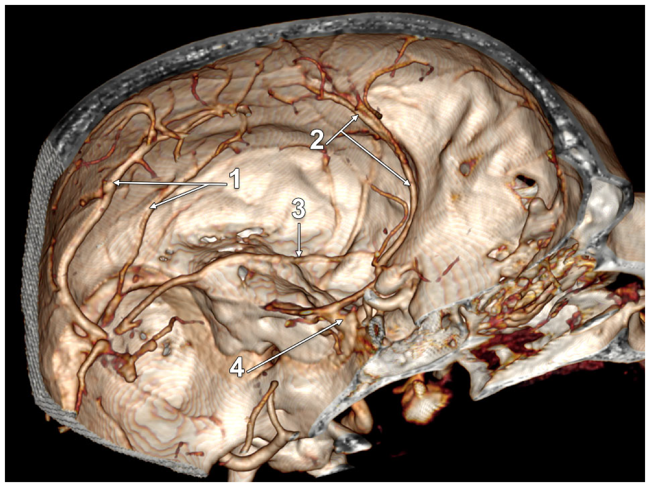 Tomography 08 00183 g004 550