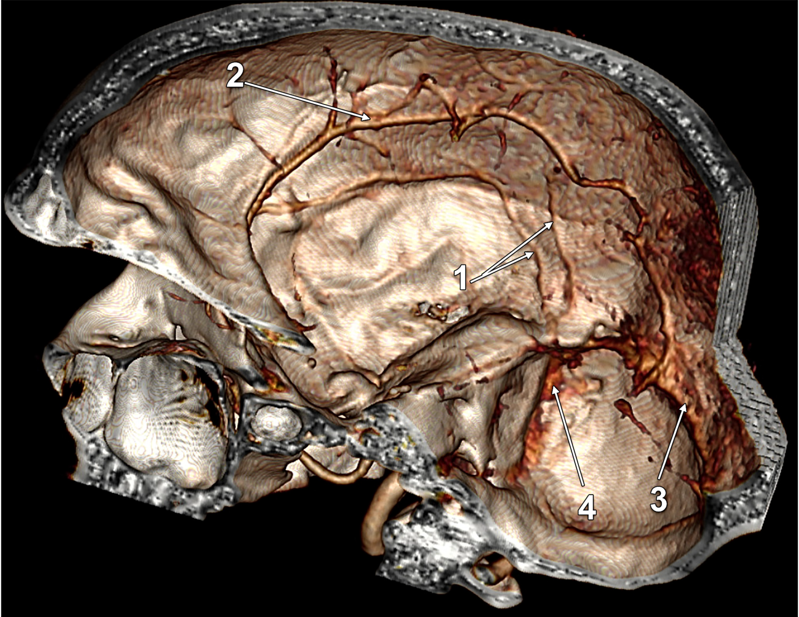 Tomography 08 00183 g006 550