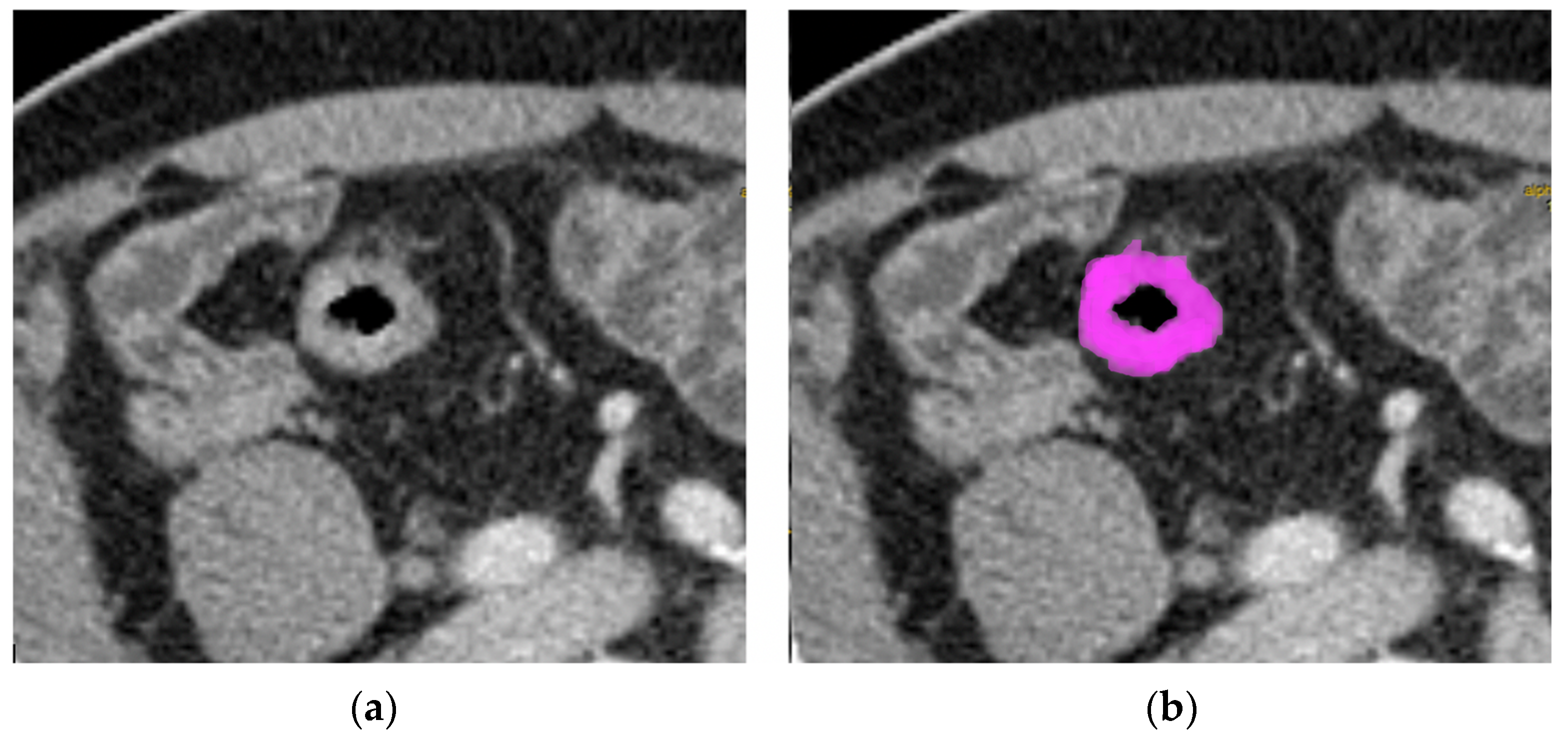 Tomography 08 00184 g001