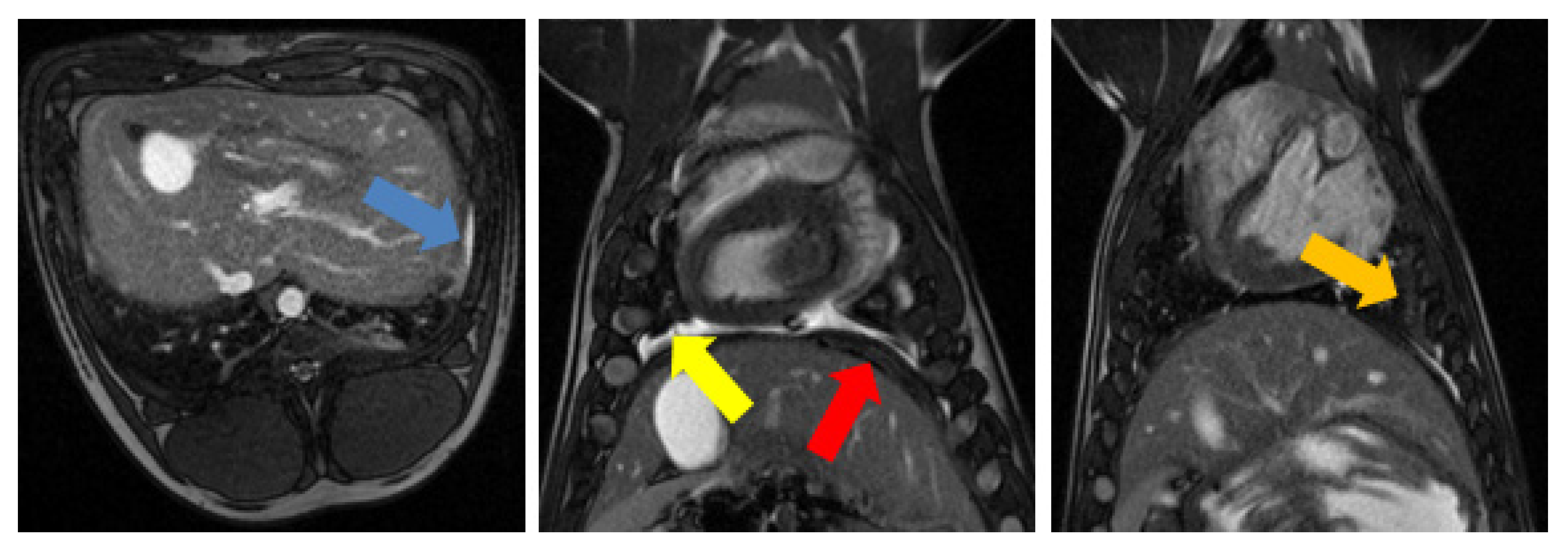 Tomography 08 00187 g003 Tomography 08 00187 g003