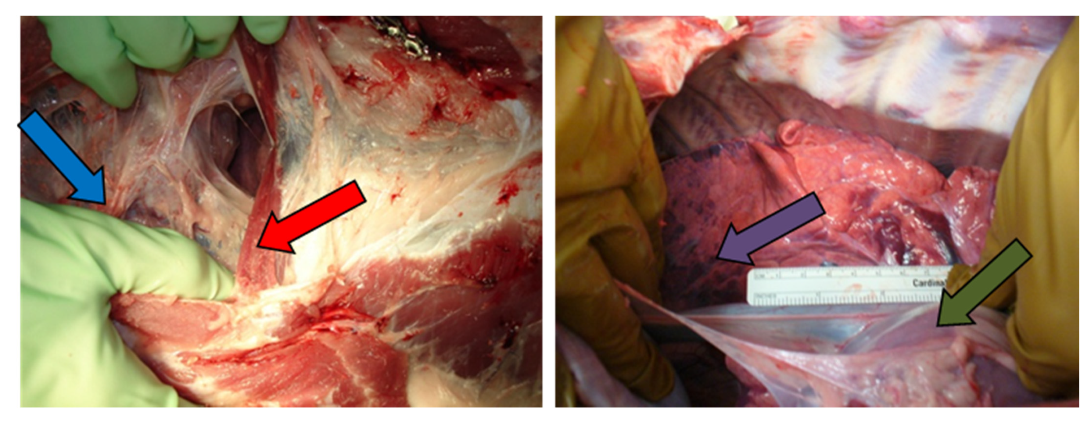 Tomography 08 00187 g004 Tomography 08 00187 g004