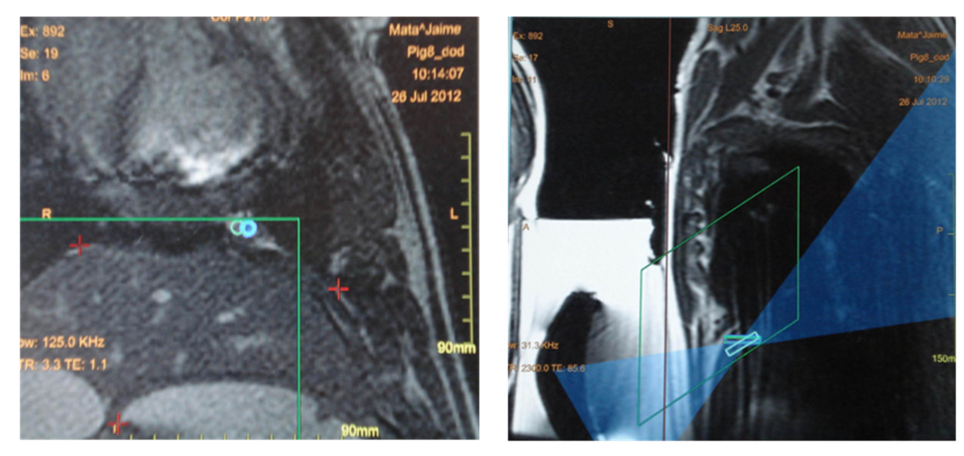 Tomography 08 00187 g006 Tomography 08 00187 g006