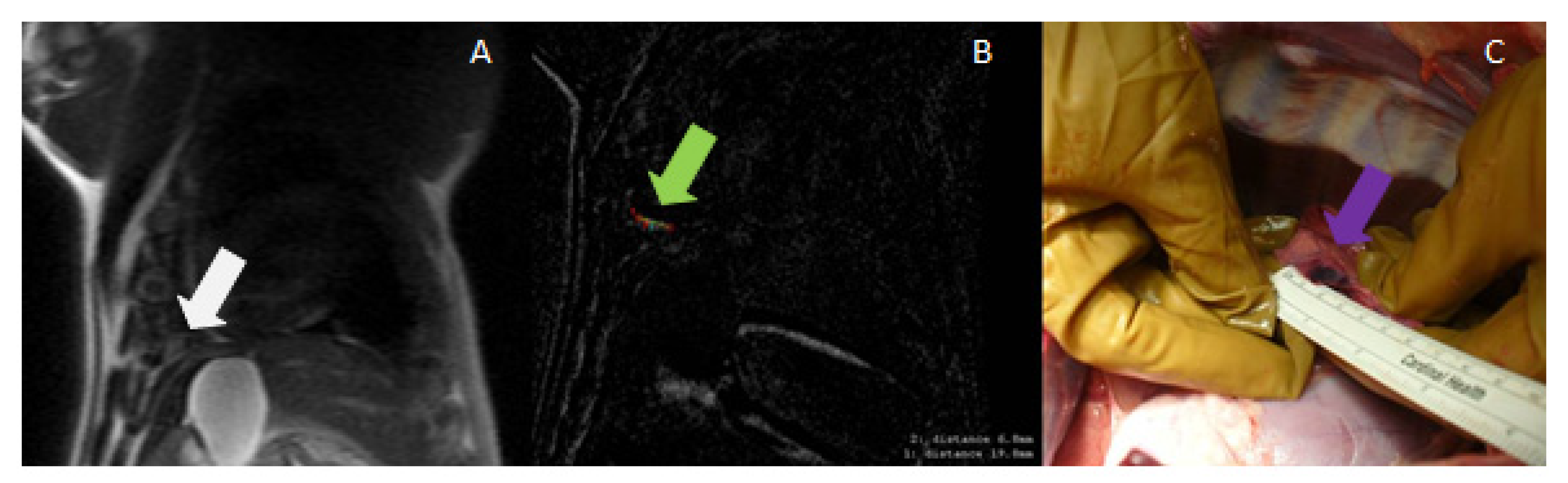 Tomography 08 00187 g007 Tomography 08 00187 g007
