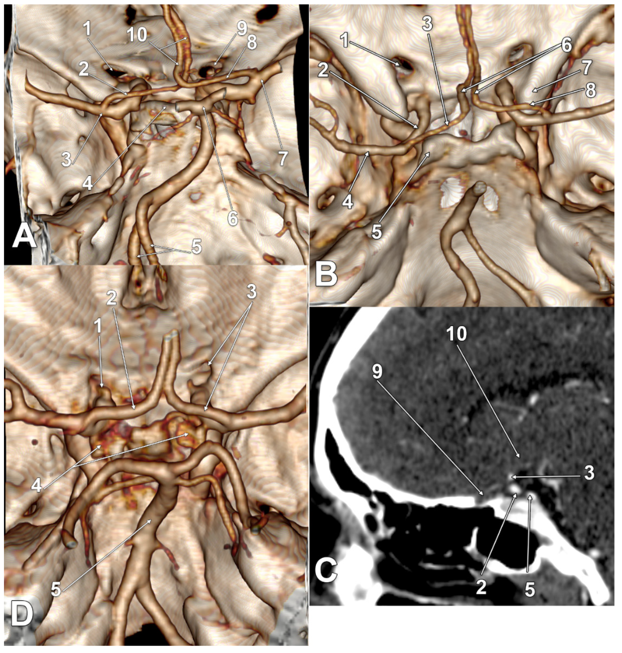 Tomography 08 00188 g003