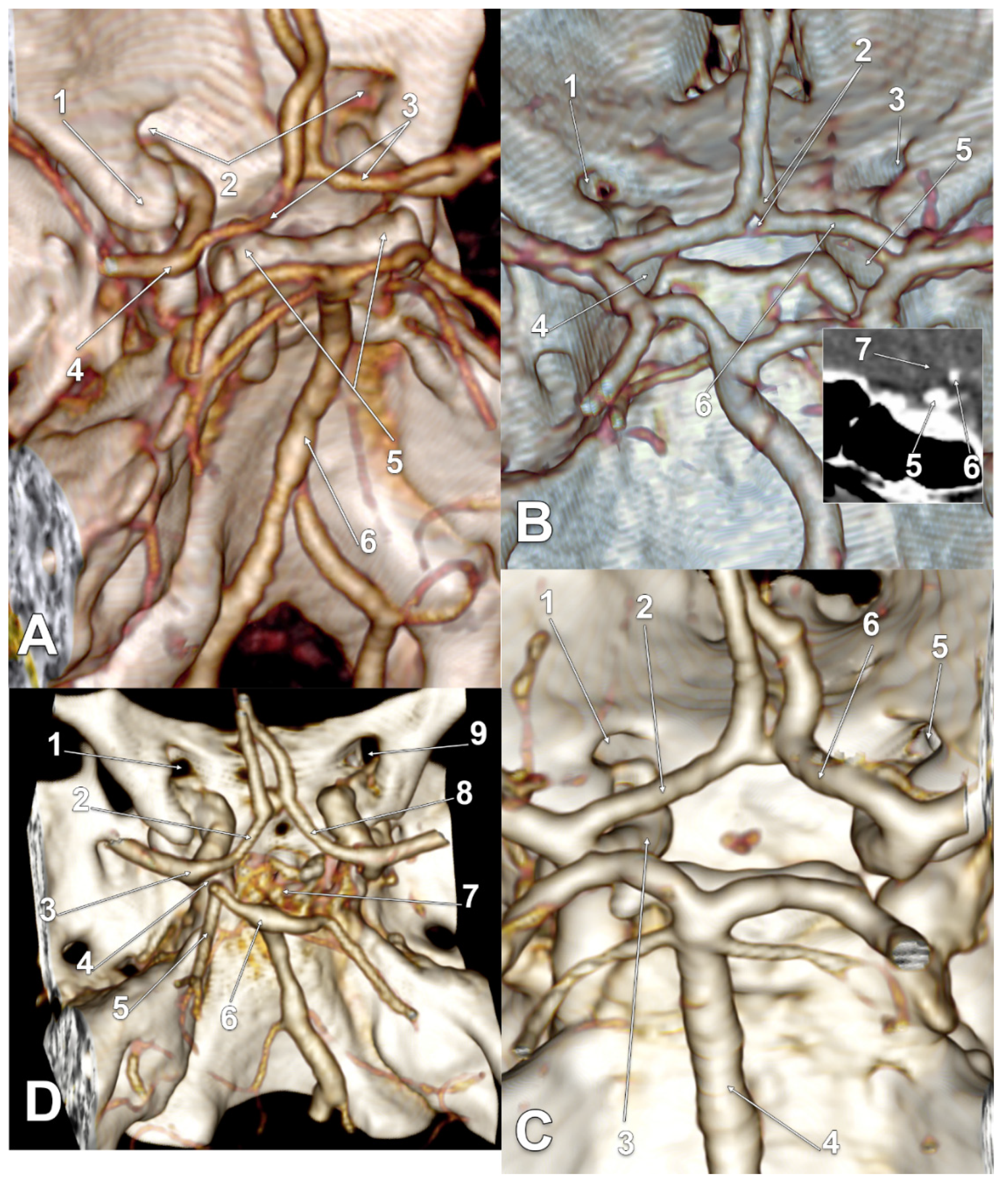 Tomography 08 00188 g004