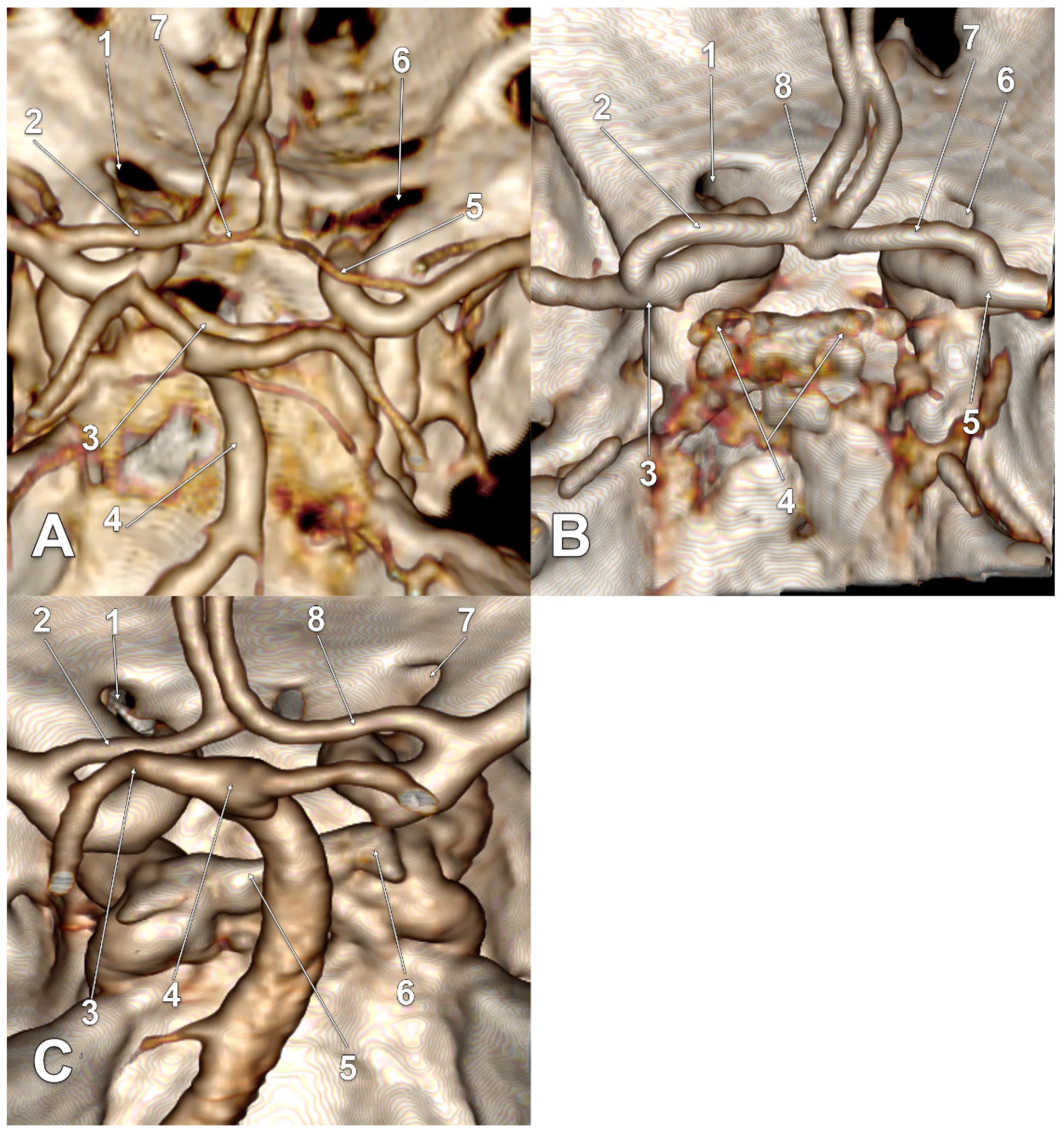 Tomography 08 00188 g005