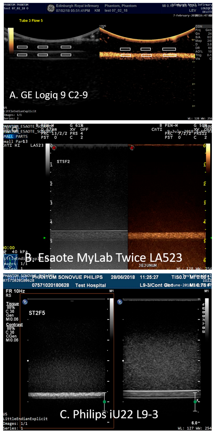 Tomography 08 00191 g003 550