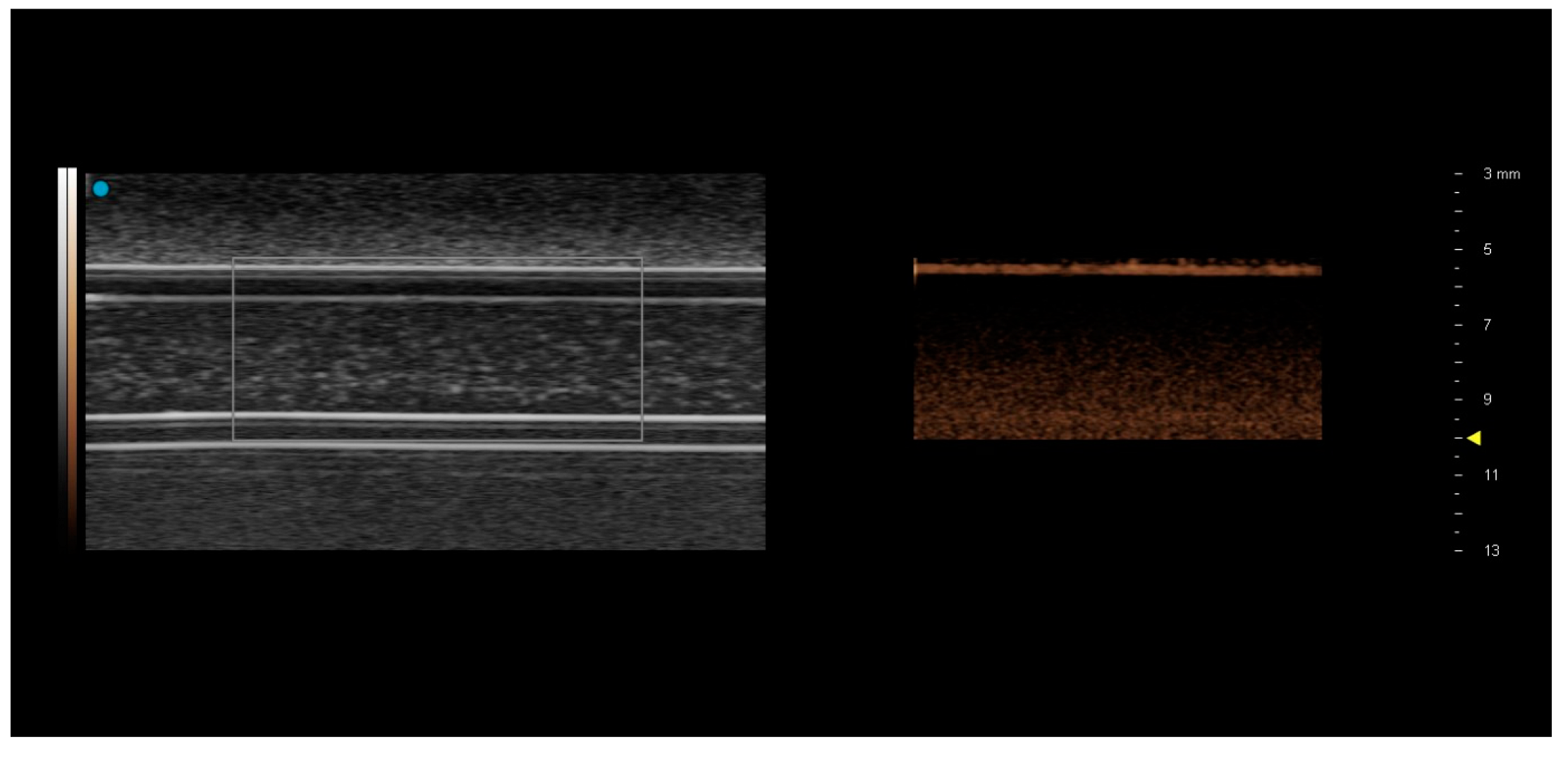 Tomography 08 00191 g004 550