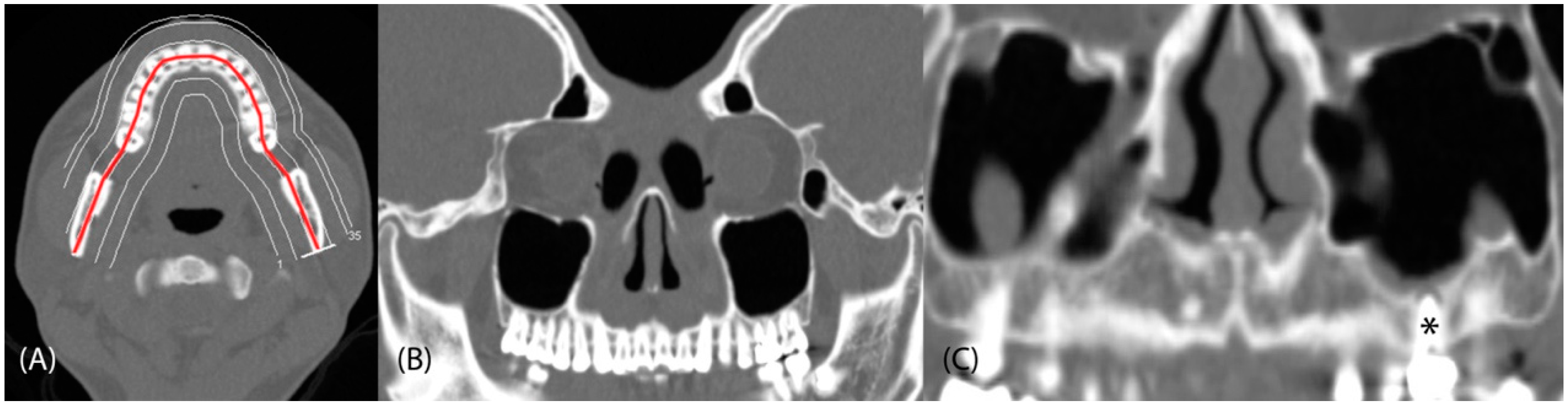 Tomography 08 00194 g001 Tomography 08 00194 g001