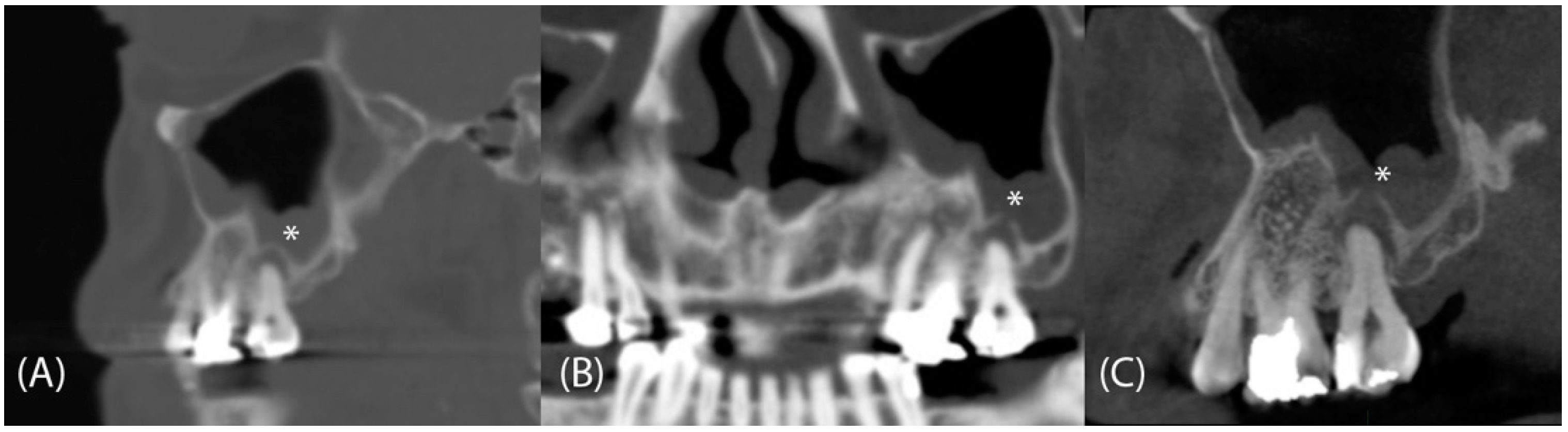 Tomography 08 00194 g002 Tomography 08 00194 g002