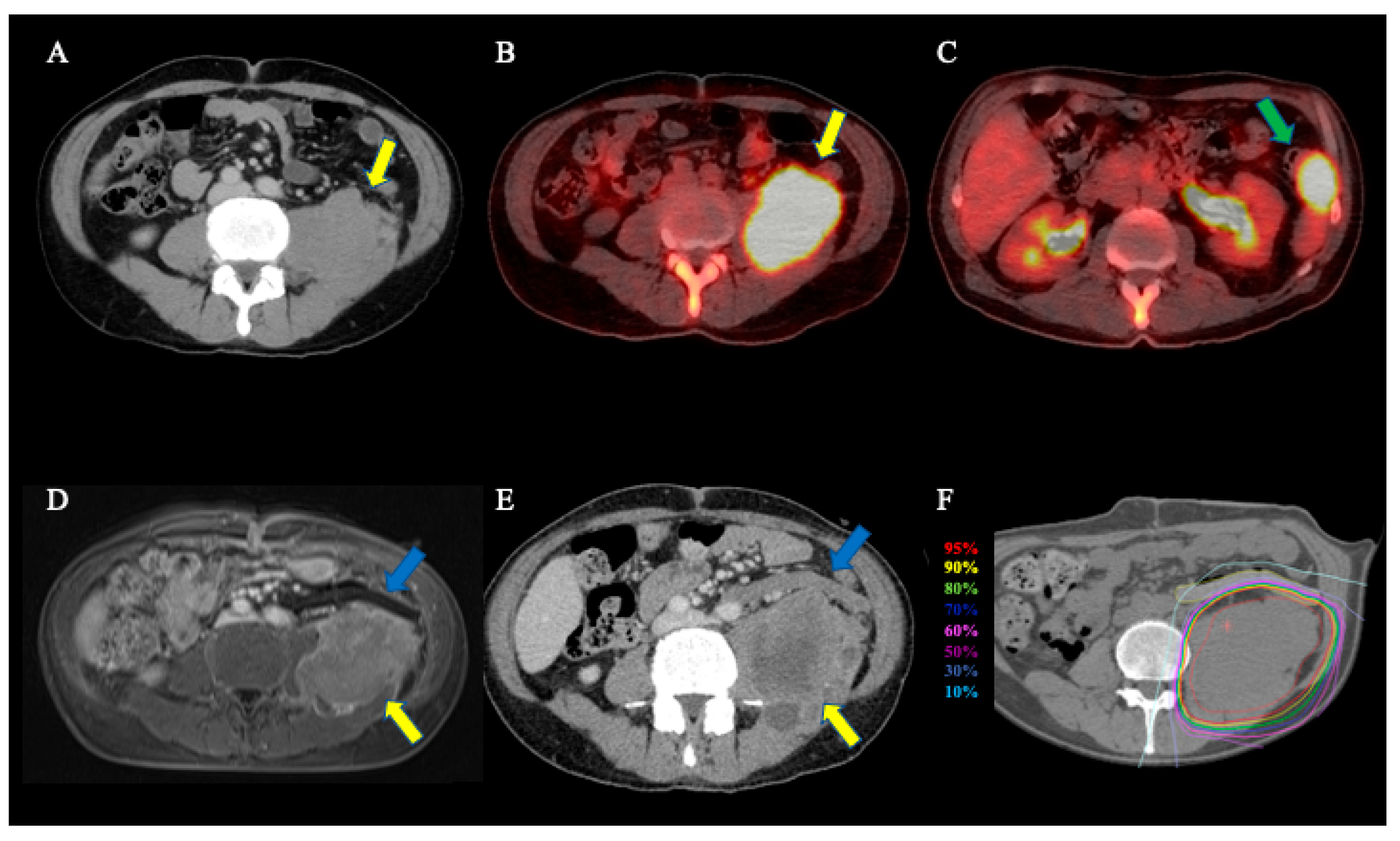 Tomography 08 00195 g001