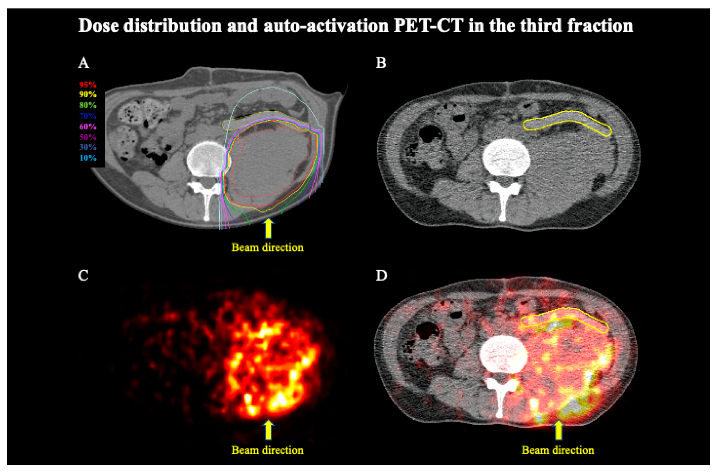 Tomography 08 00195 g003
