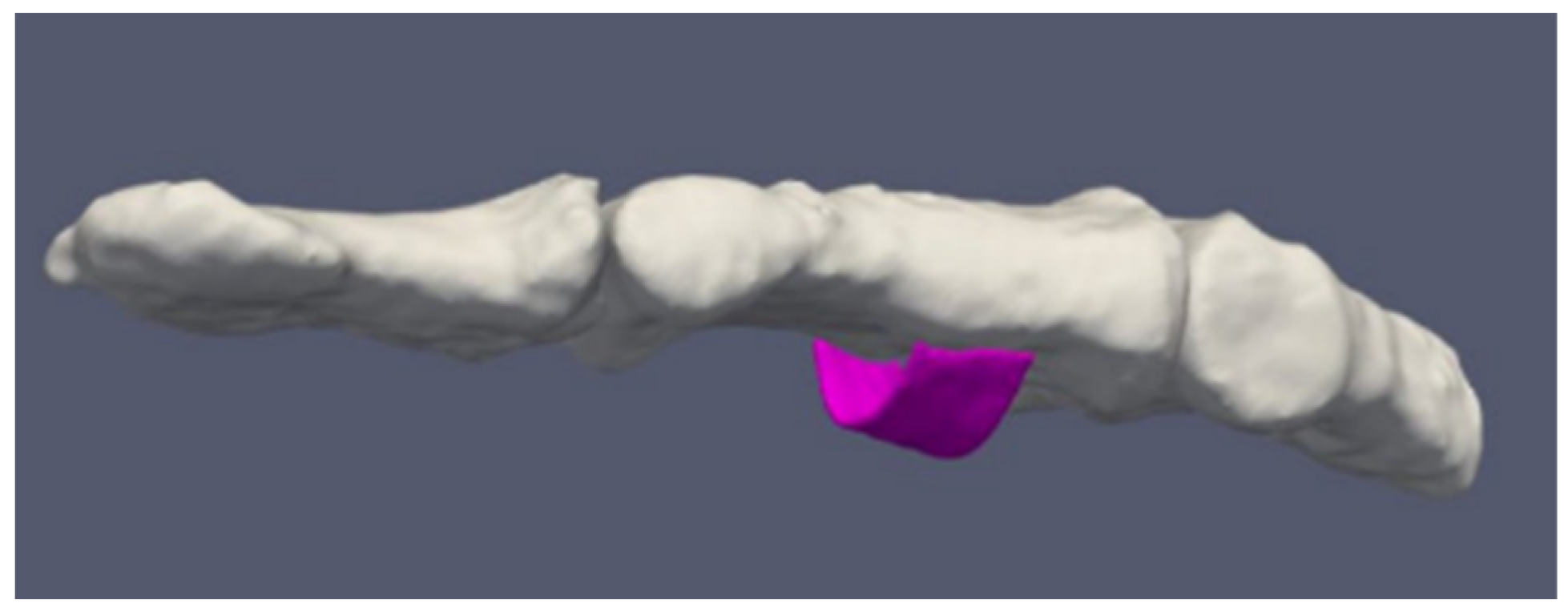 Tomography 08 00196 g003
