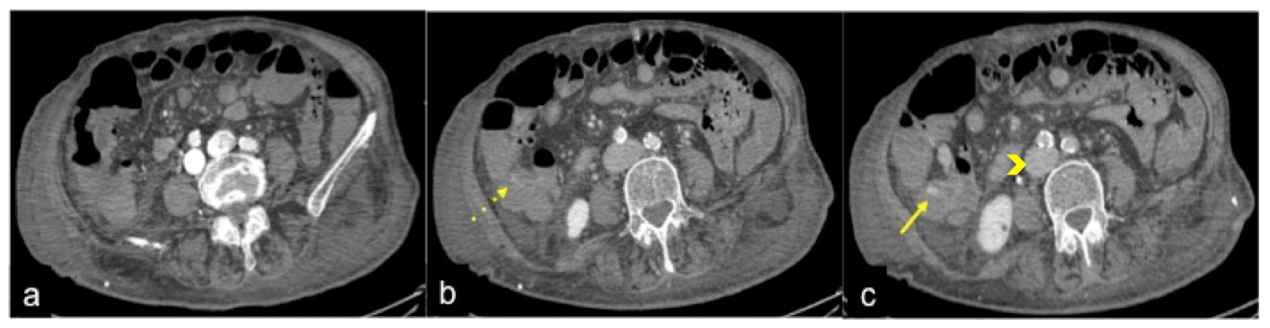 Tomography 08 00198 g004 Tomography 08 00198 g004