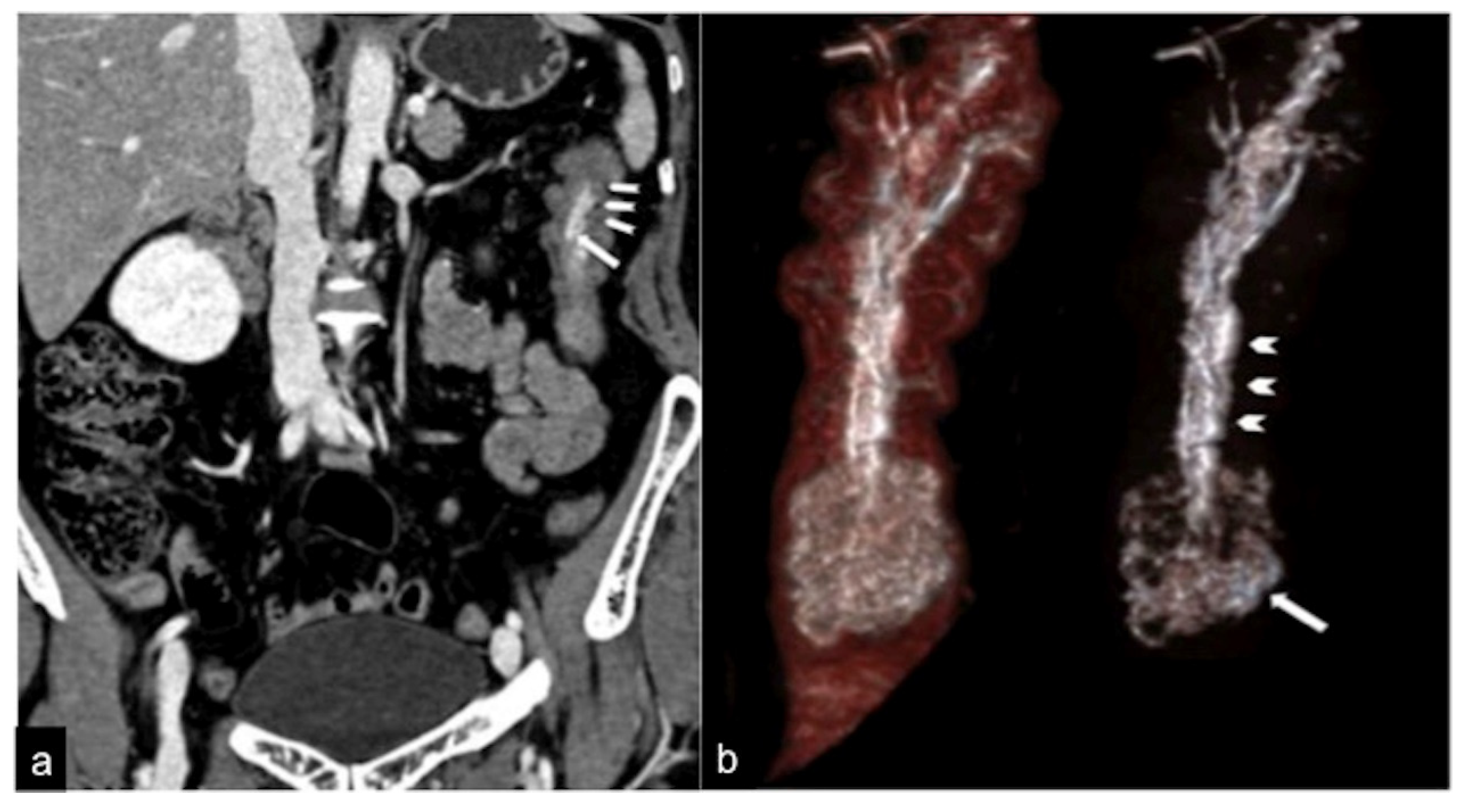 Tomography 08 00198 g006 Tomography 08 00198 g006