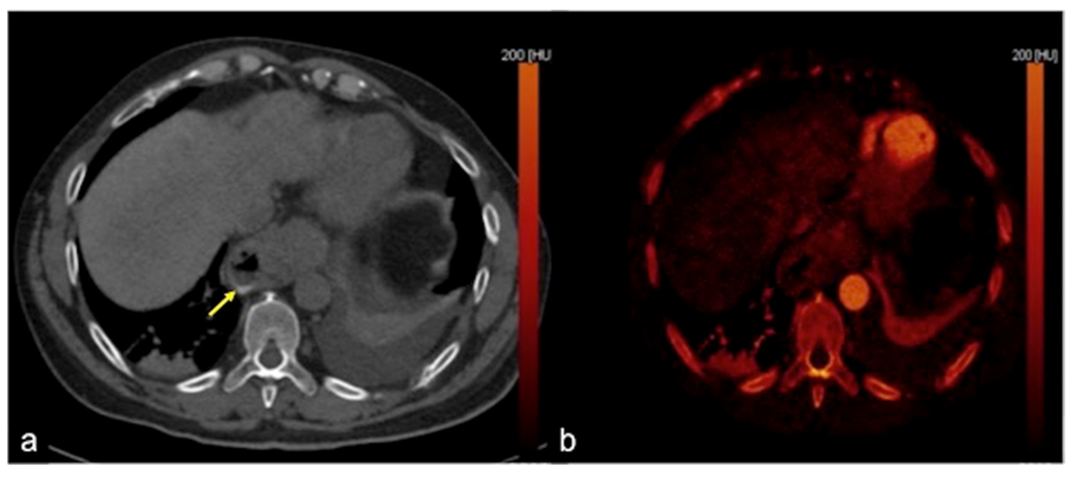 Tomography 08 00198 g008 Tomography 08 00198 g008