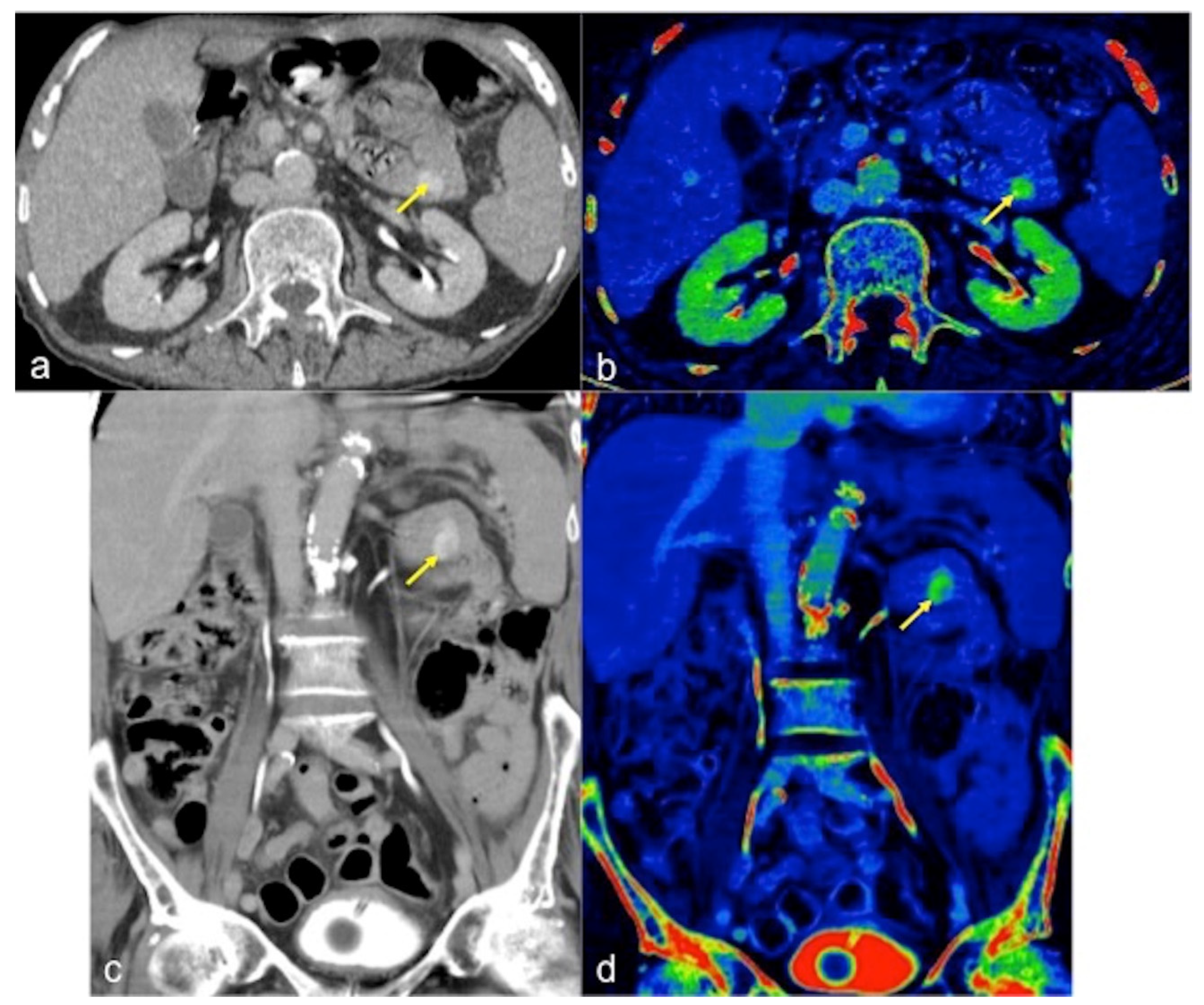 Tomography 08 00198 g009 Tomography 08 00198 g009