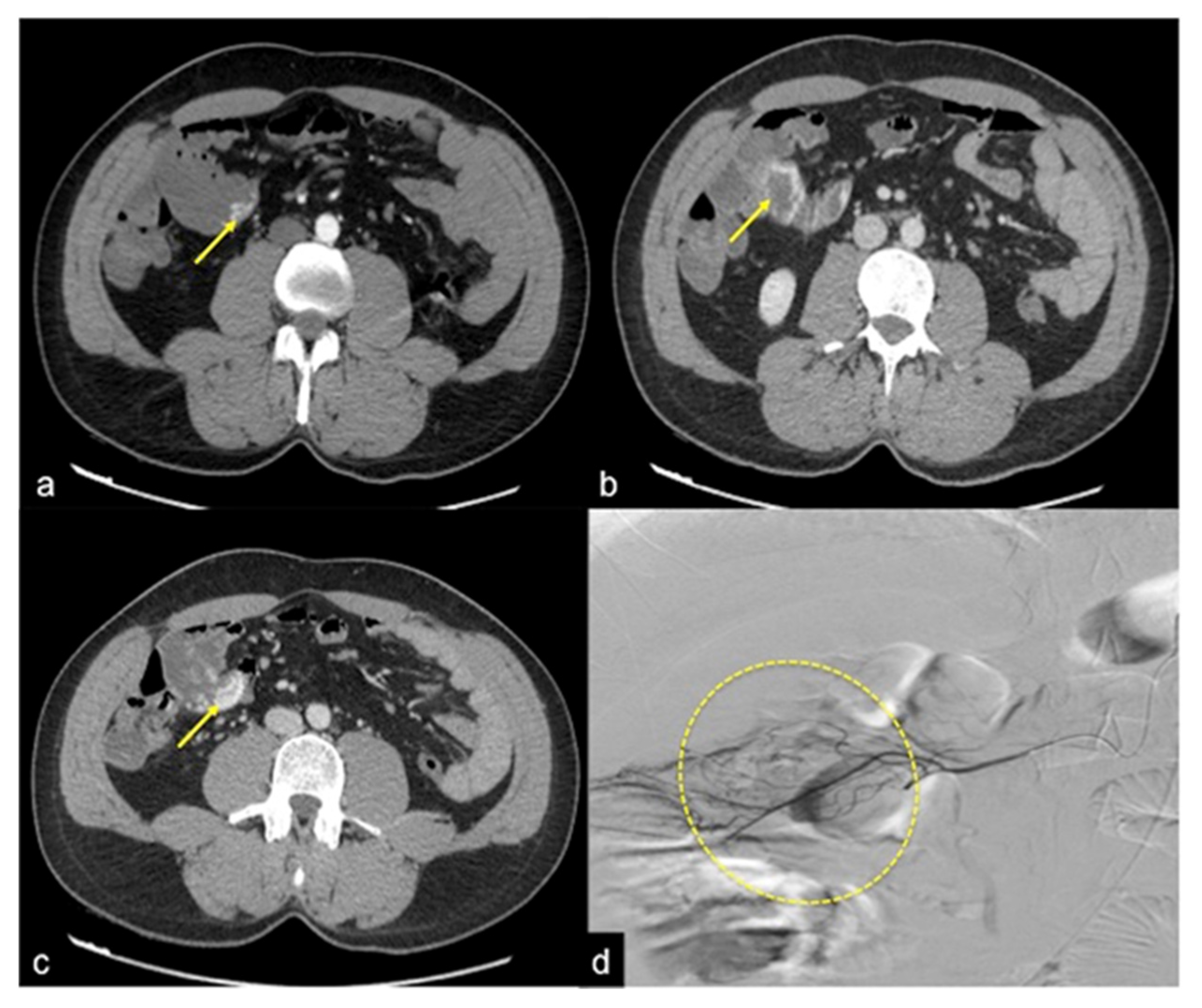 Tomography 08 00198 g011 Tomography 08 00198 g011