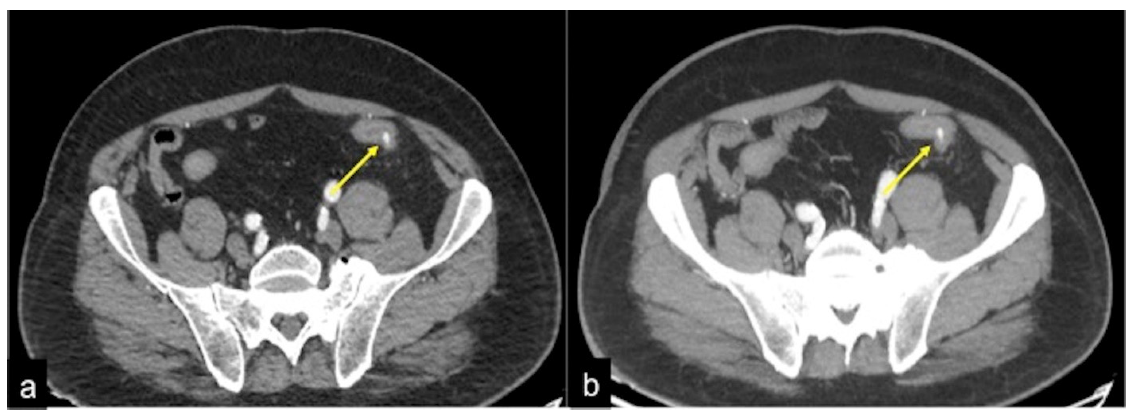 Tomography 08 00198 g012 Tomography 08 00198 g012