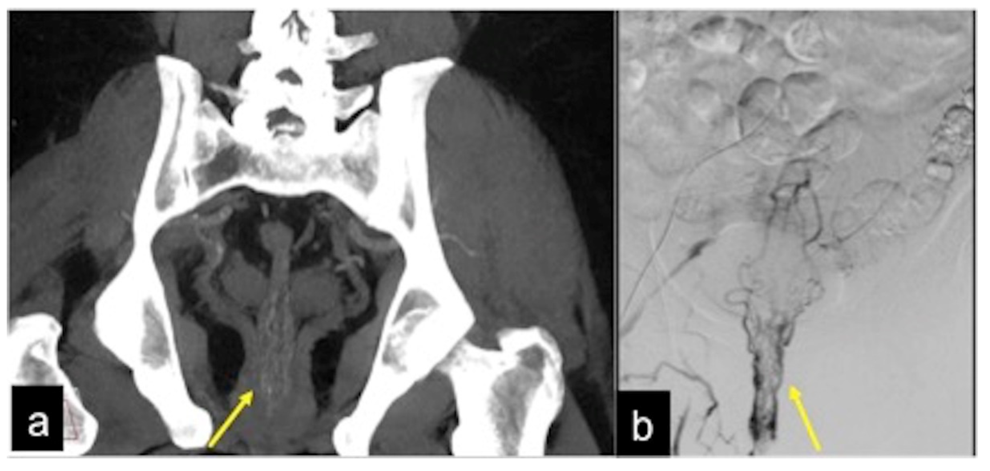 Tomography 08 00198 g017 Tomography 08 00198 g017