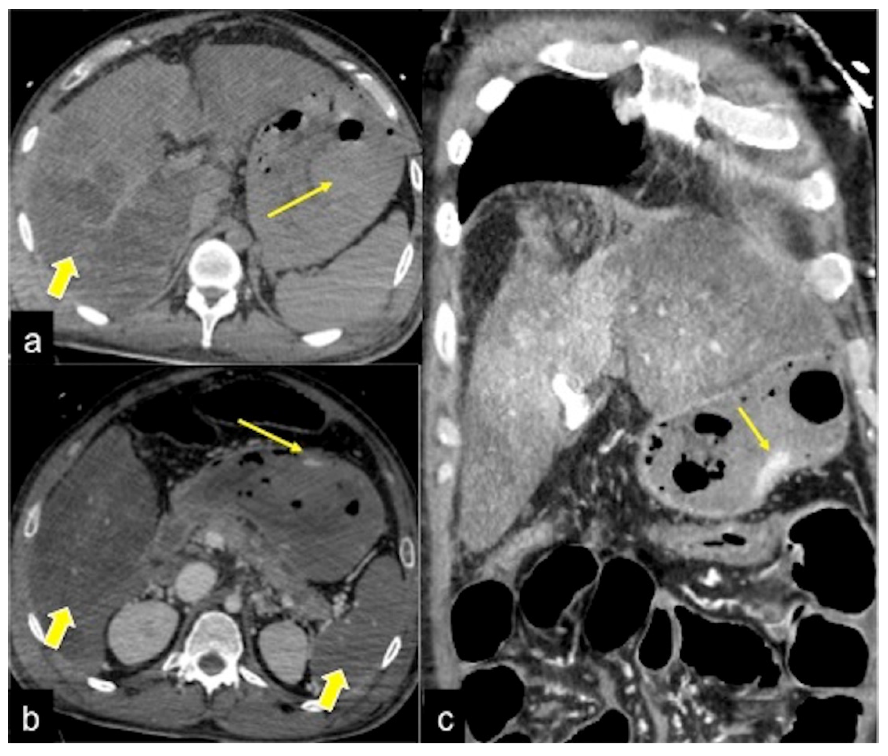 Tomography 08 00198 g020 Tomography 08 00198 g020