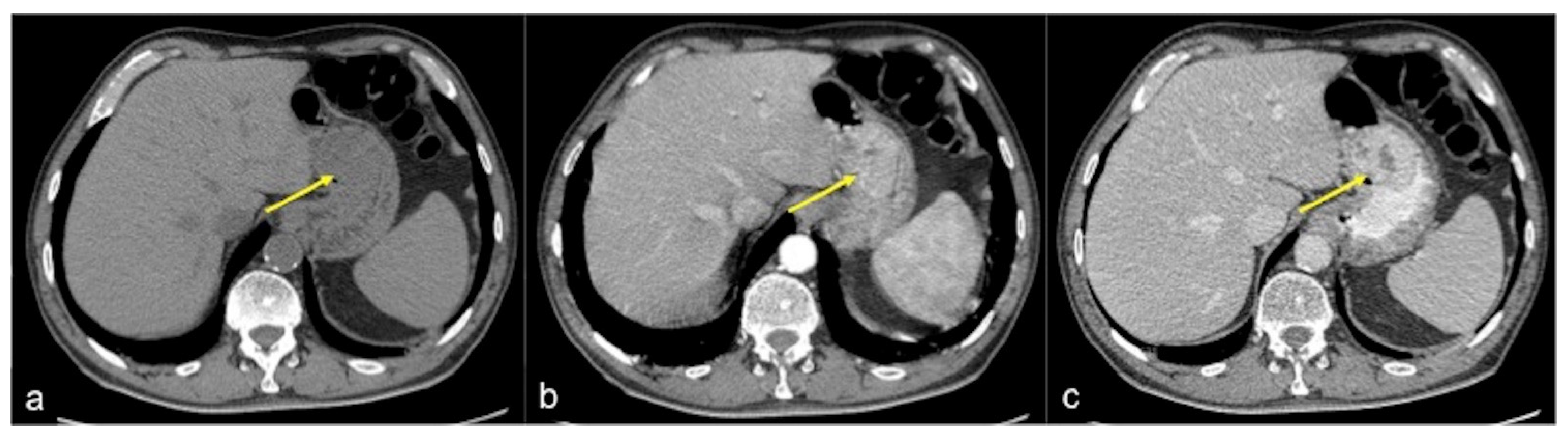 Tomography 08 00198 g026 Tomography 08 00198 g026
