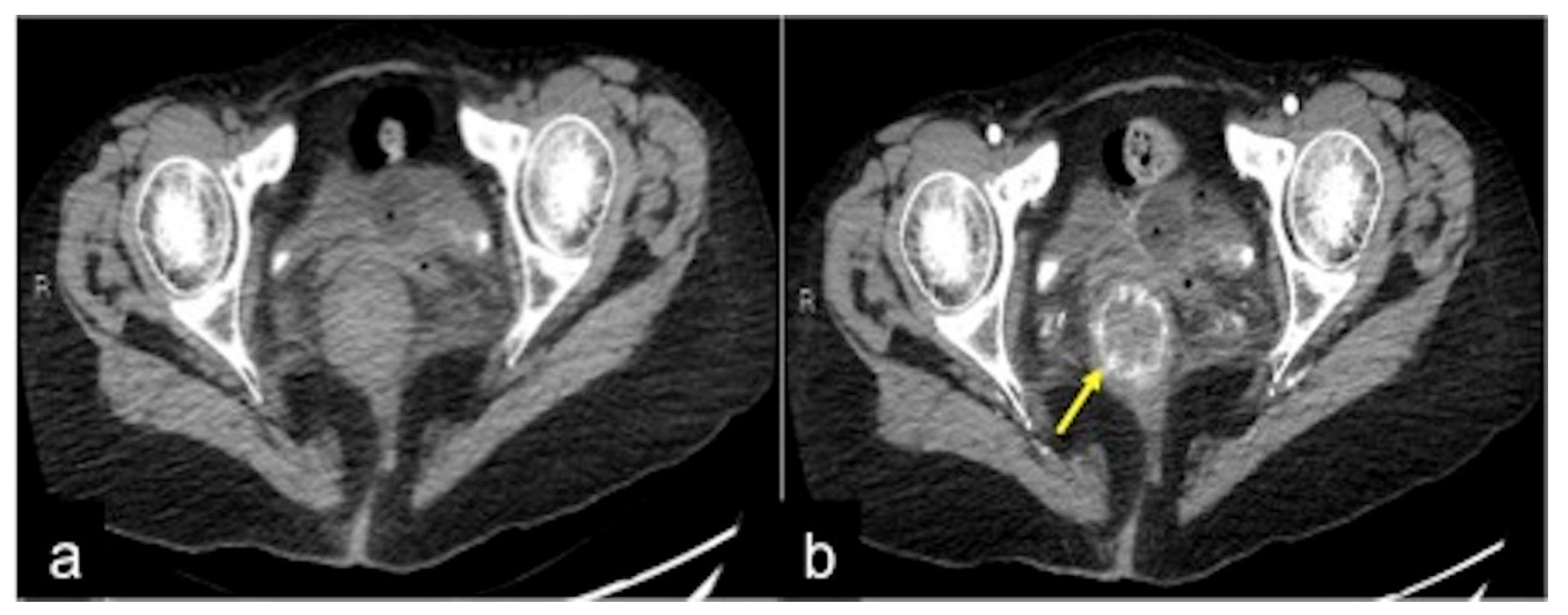 Tomography 08 00198 g042 Tomography 08 00198 g042
