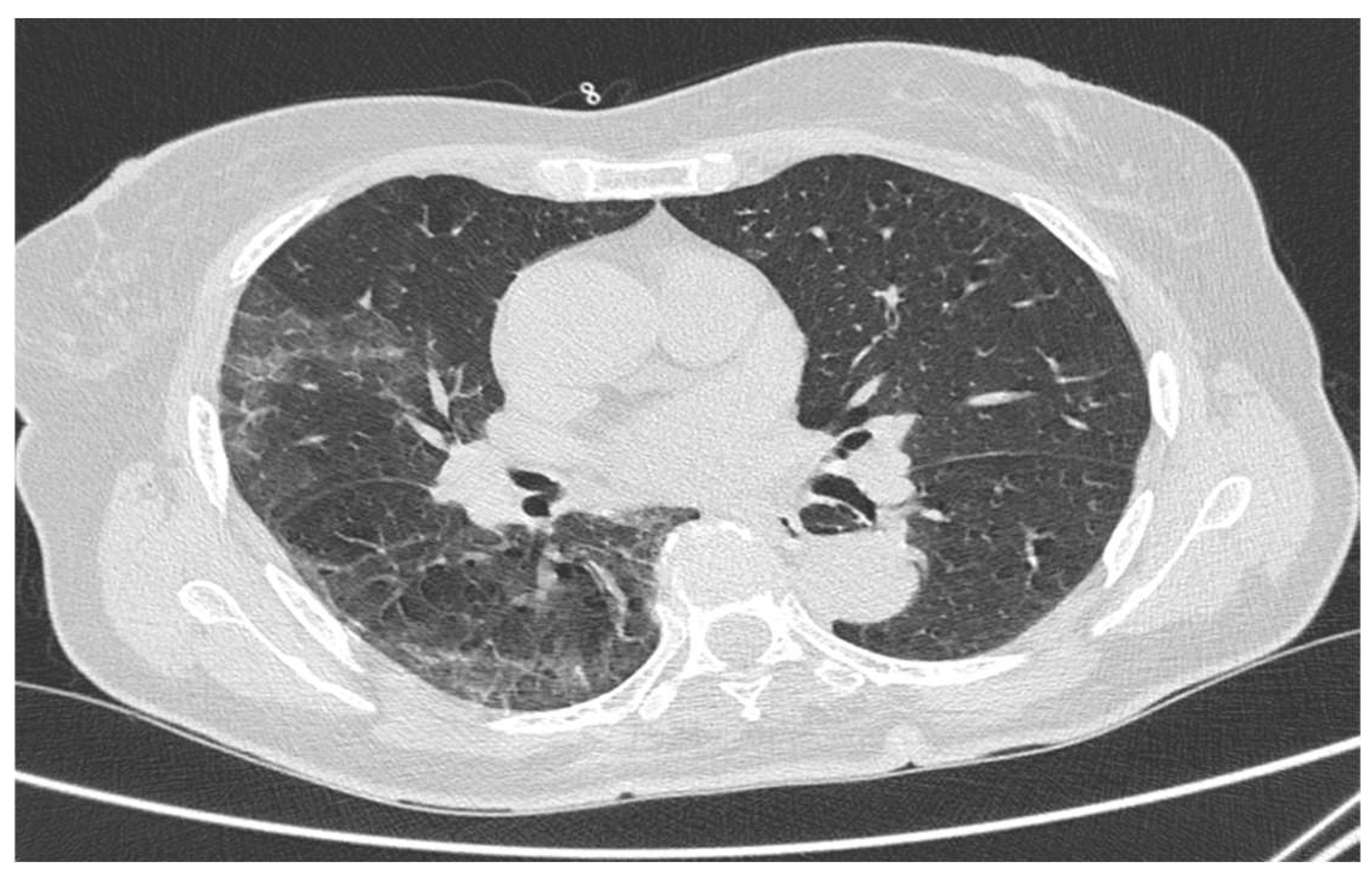 Tomography 08 00199 g002