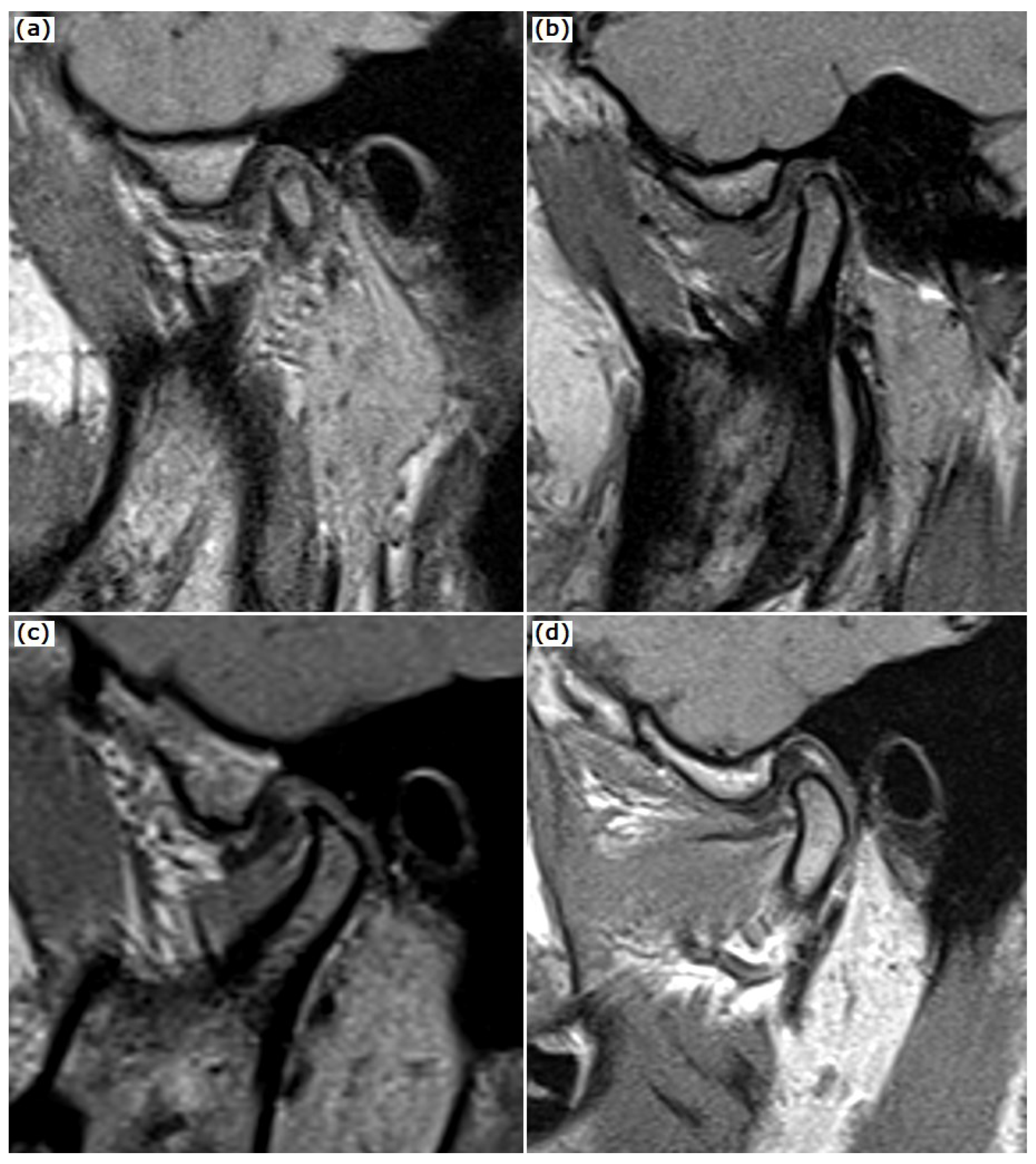 Tomography 08 00204 g001 Tomography 08 00204 g001