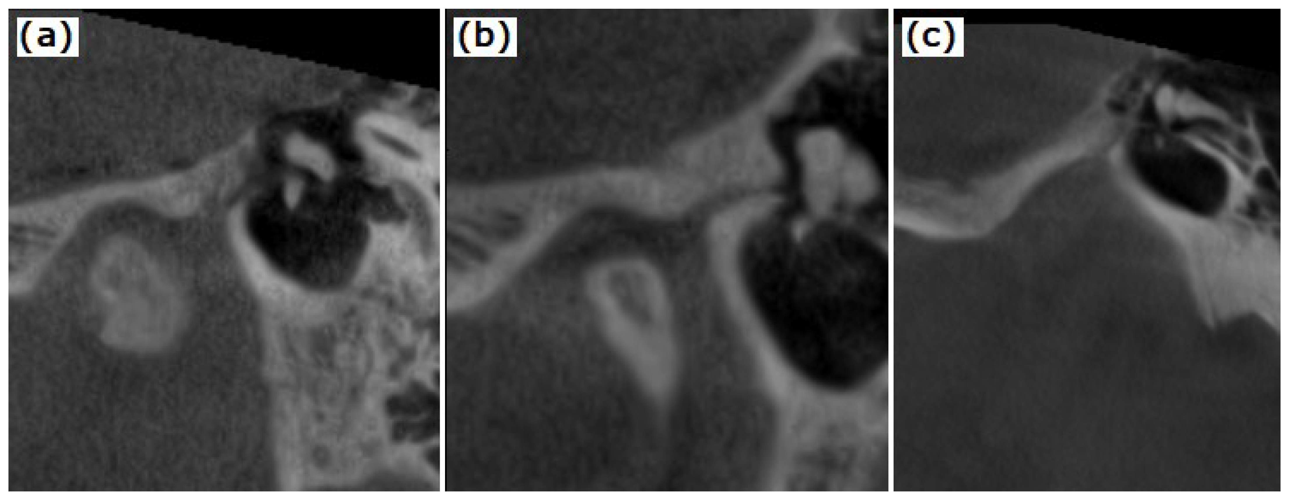 Tomography 08 00204 g002 Tomography 08 00204 g002