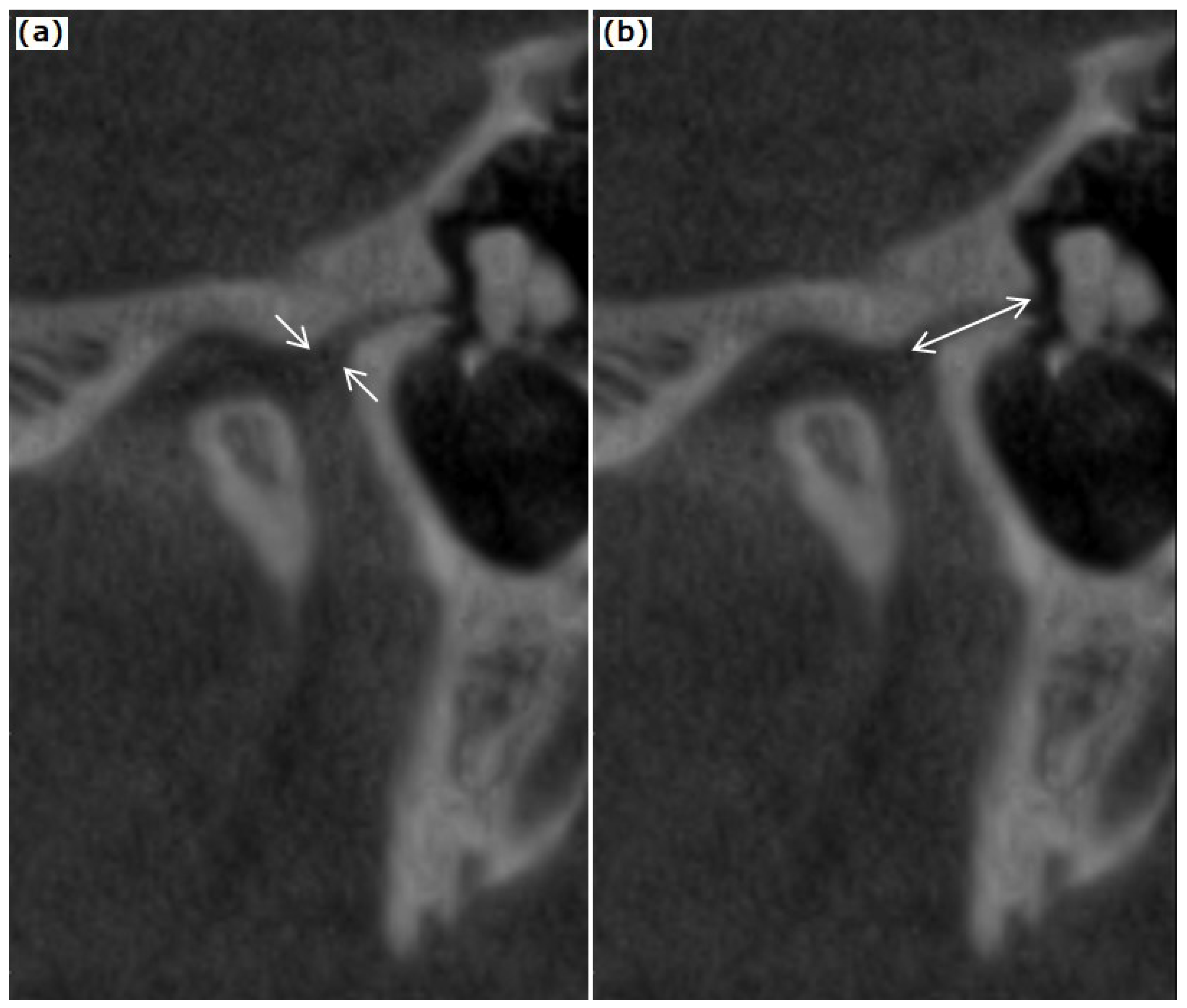 Tomography 08 00204 g003 Tomography 08 00204 g003