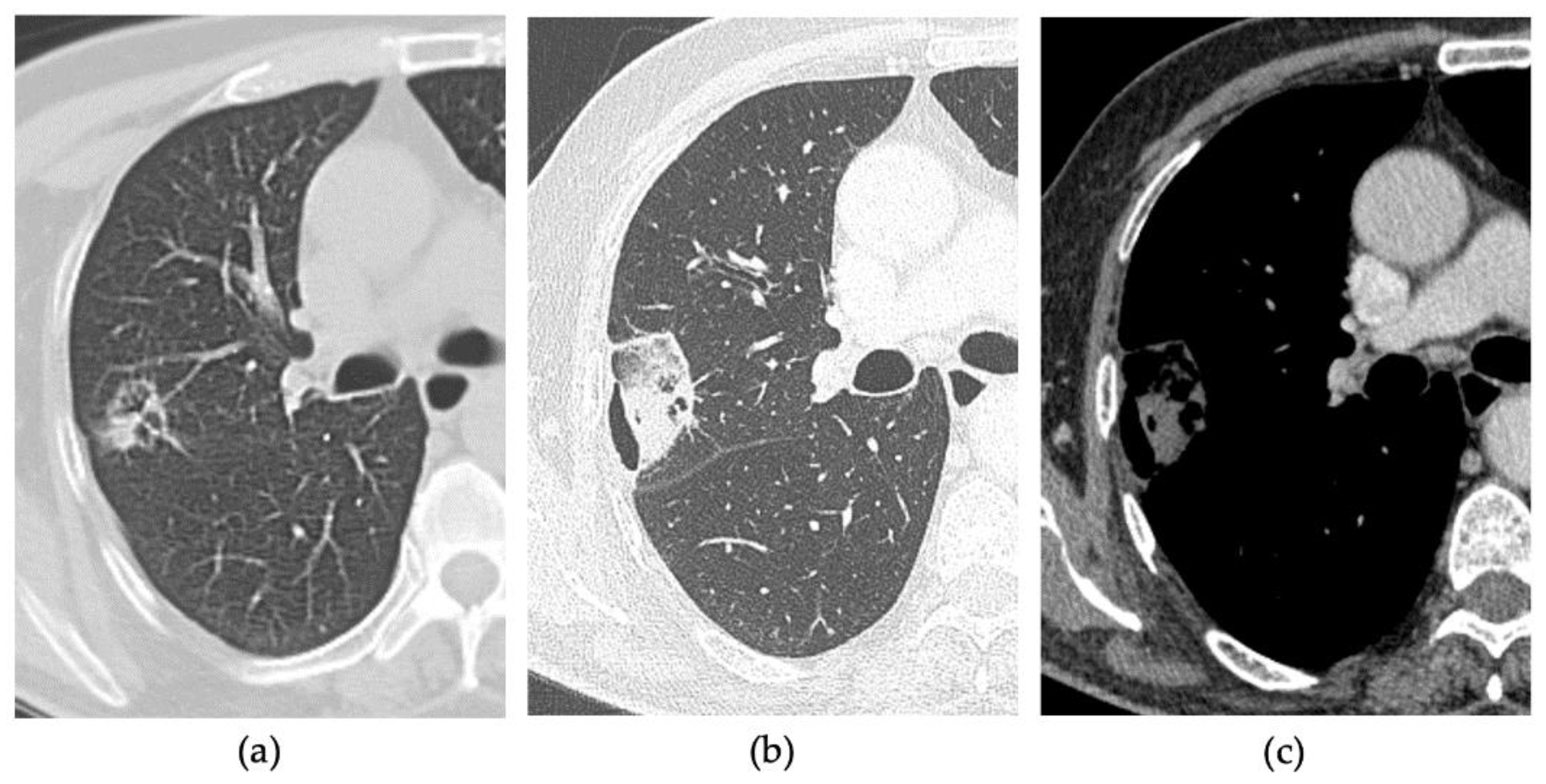 Tomography 08 00206 g004