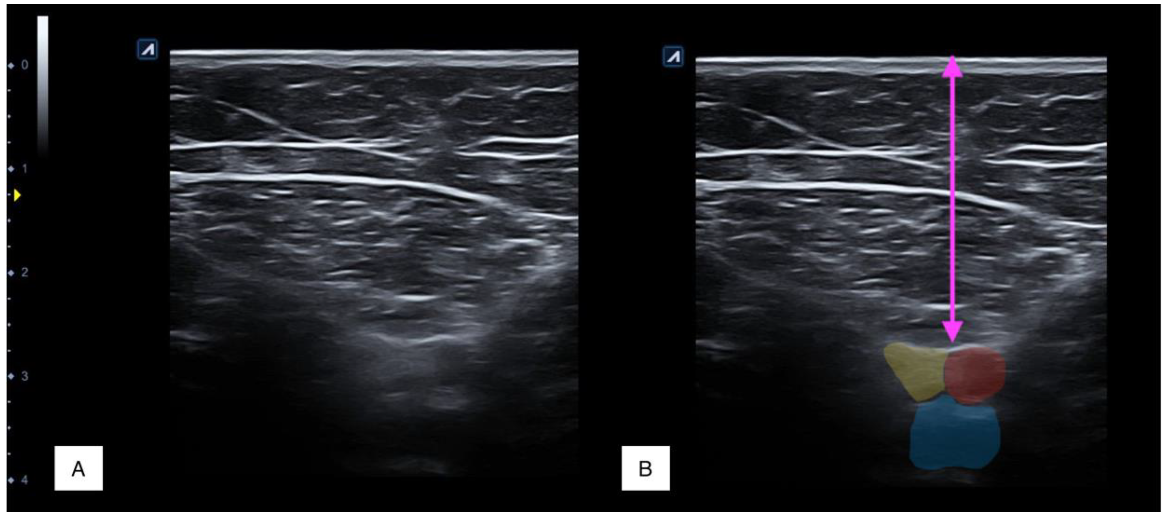 Tomography 08 00208 g002 Tomography 08 00208 g002